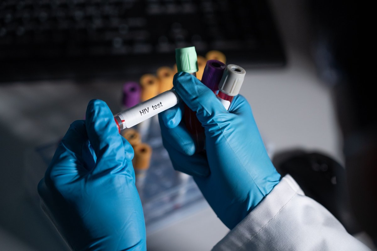 Na jugu Afrike pričeli s prelomnim cepljenjem proti okužbi s HIV