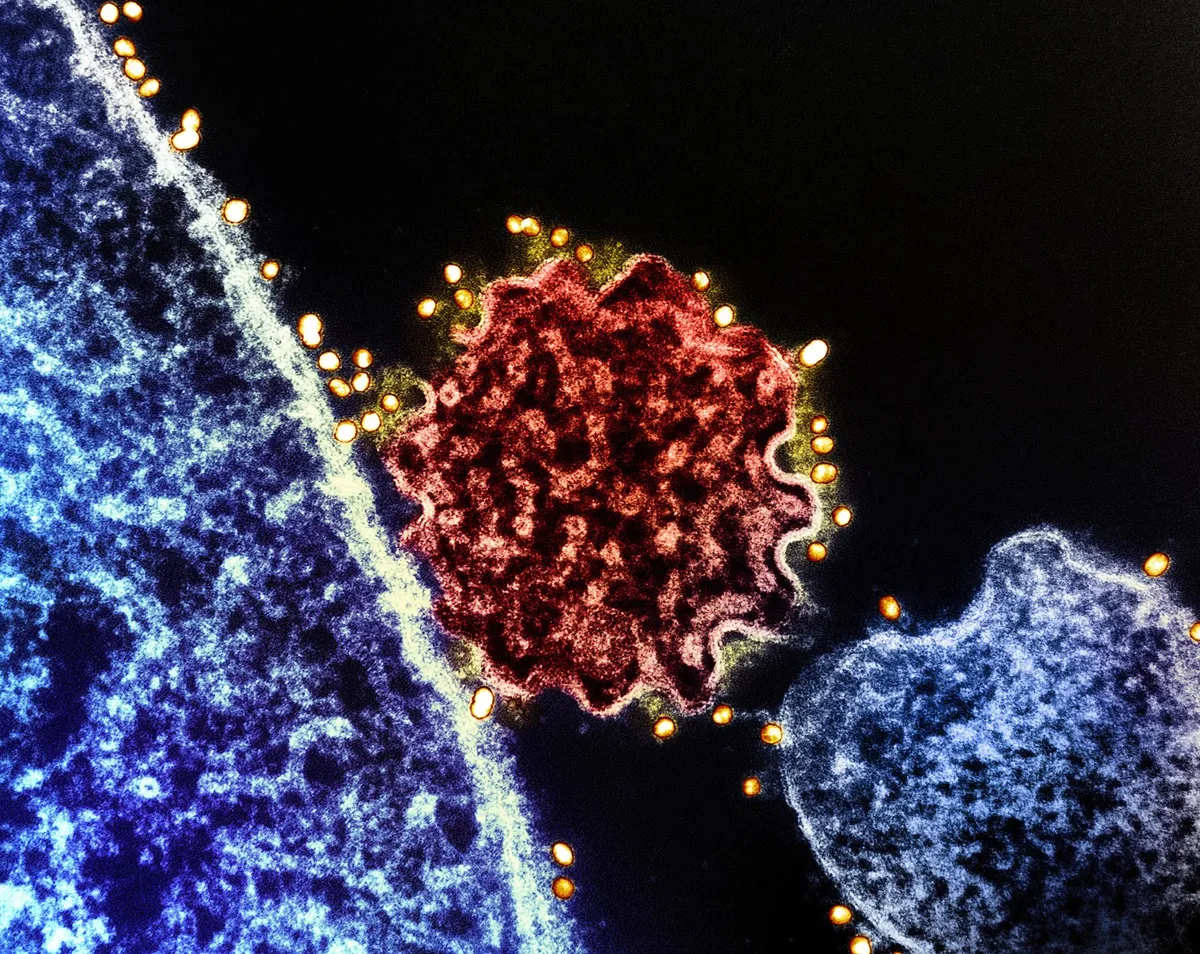 Kaj je virus nipah, ki je bolj smrtonosen kot virus covida-19?