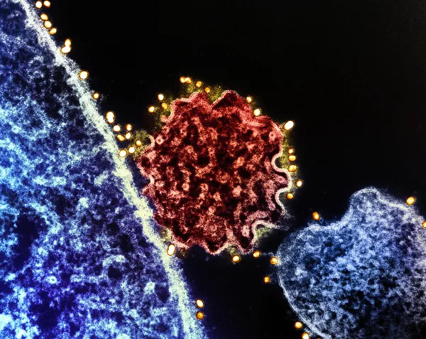 Kaj je virus nipah, ki je bolj smrtonosen kot virus covida-19?