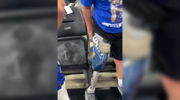 Mlad navijač z nožno protezo navdušil zvezdnika NBA: video je hit