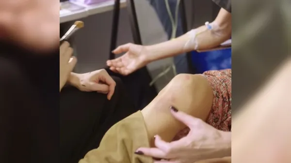 Nerodna nesreča na odru: Severina pokazala posledice