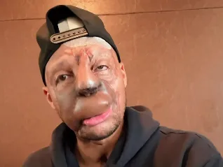 Takšna usoda bi marsikoga uničila, vendar on iz nje črpa neverjetno moč