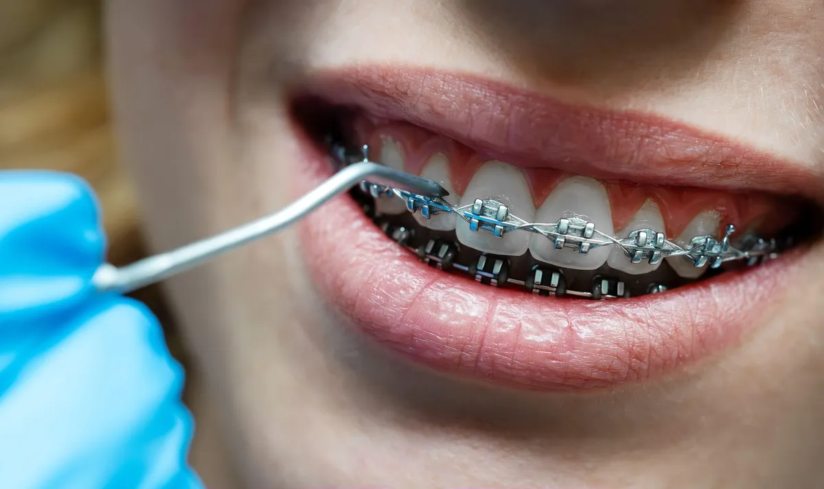 Čakalne dobe za ortodontski pregled izjemno dolge, a ne zato, ker bi ortodontov primanjkovalo