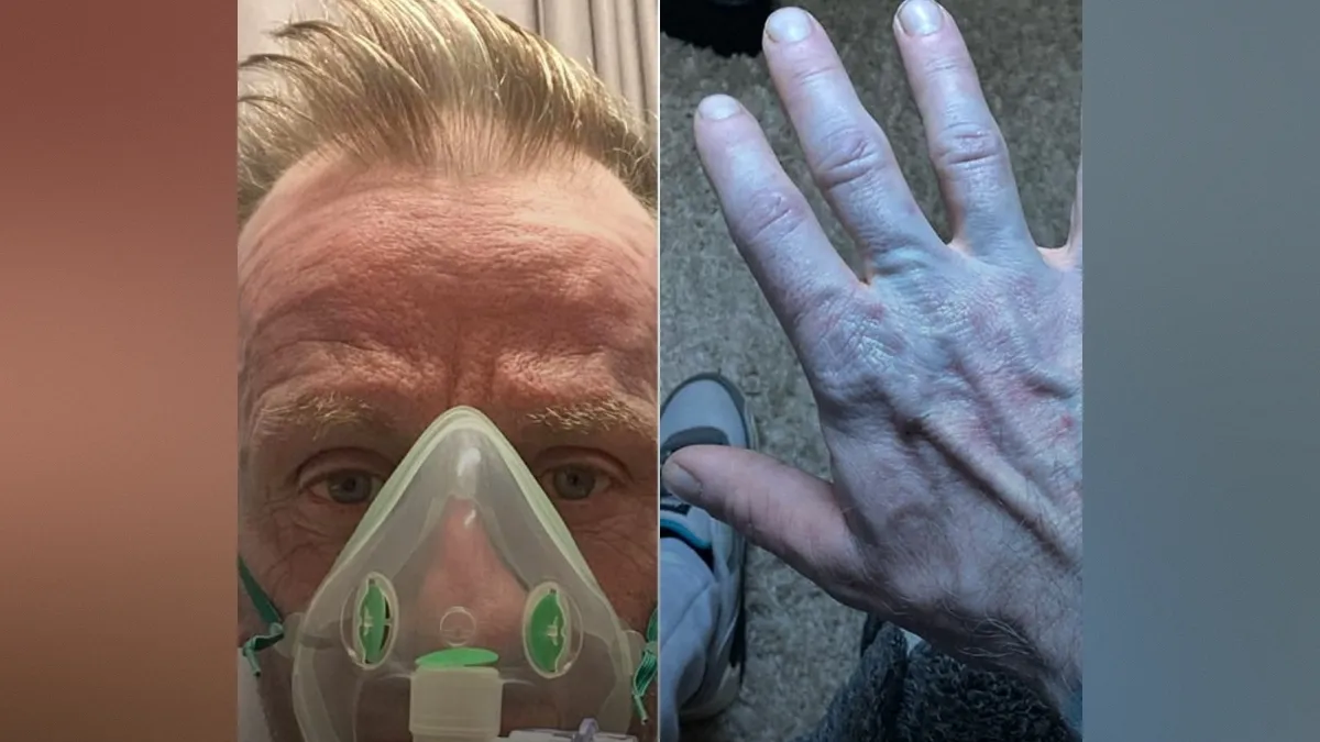 Zbudil se je popolnoma moder. Kaj so ugotovili zdravniki?