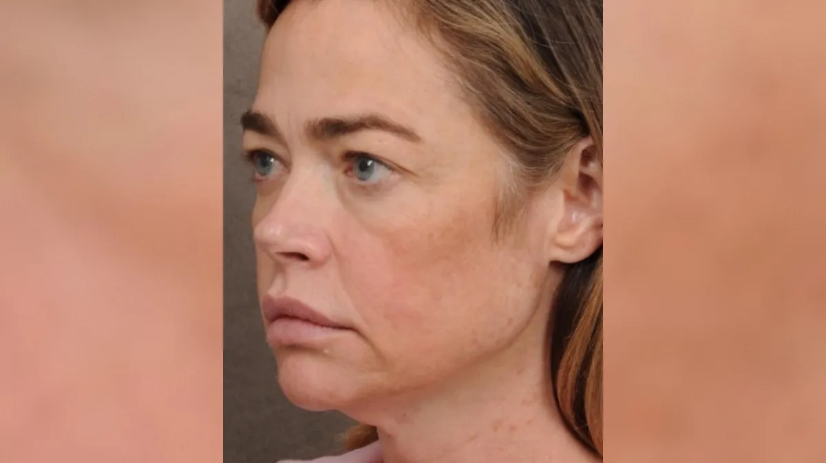 Neverjetna sprememba zvezdnice: fotografije pred in po operaciji