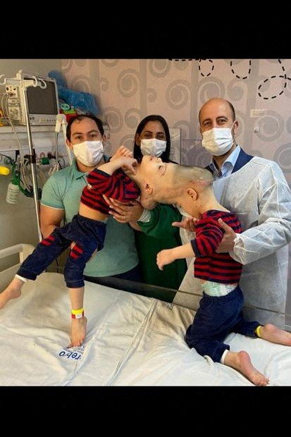 ločitev dvojčkov Brazilija