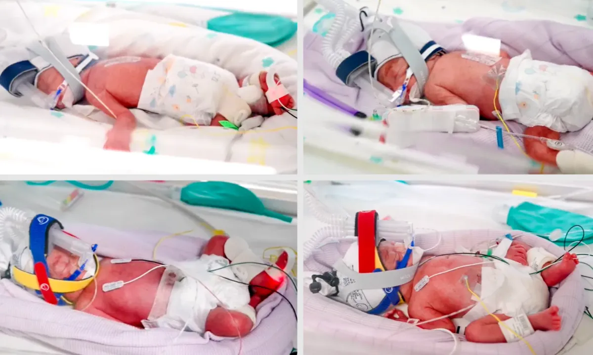 Zakoncema s štirimi otroki so se rodile izjemno redke identične četverčice
