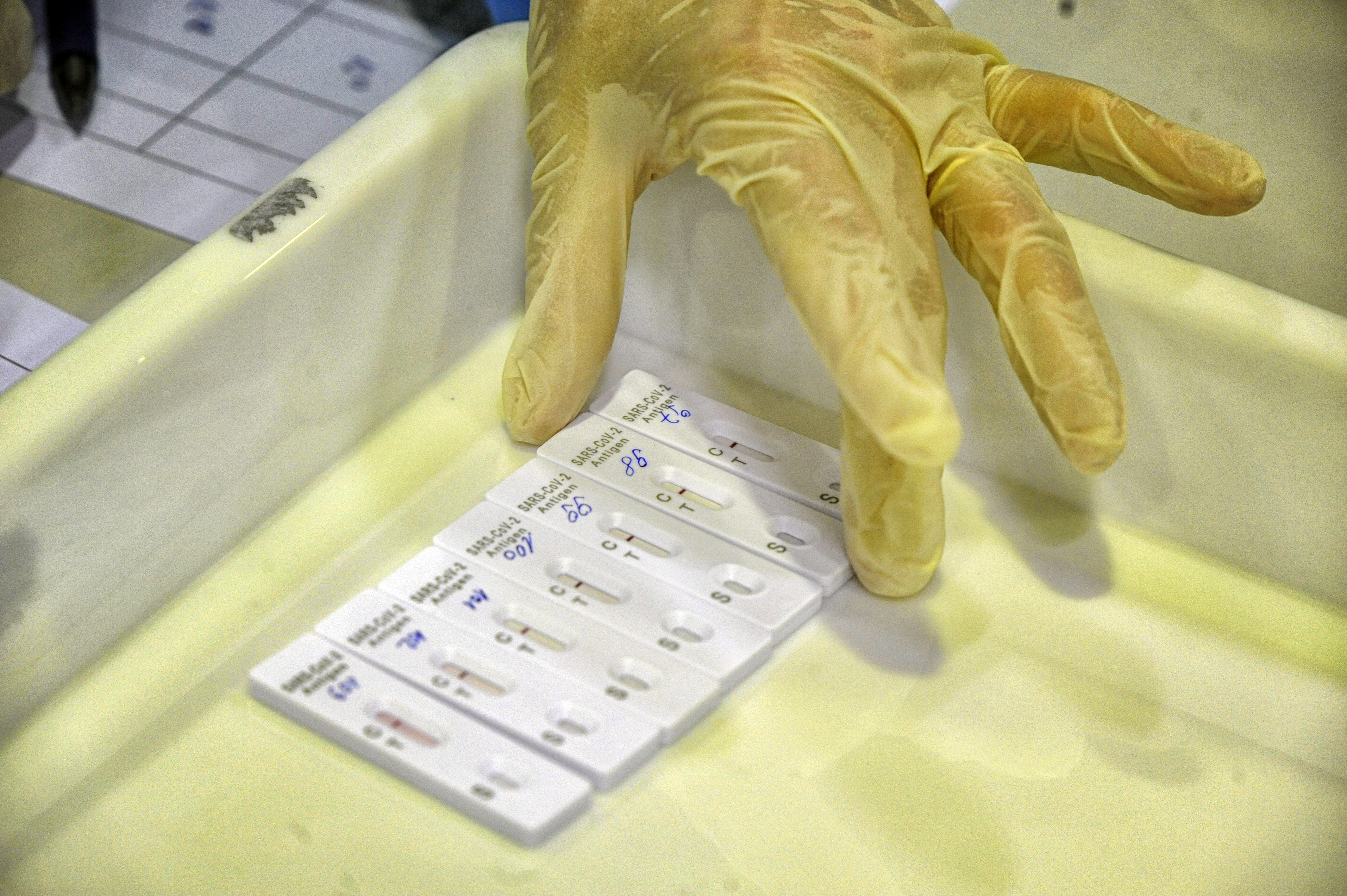 Testiranje na koronavirus, test