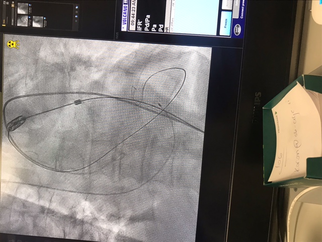 tavi, poseg, sb celje