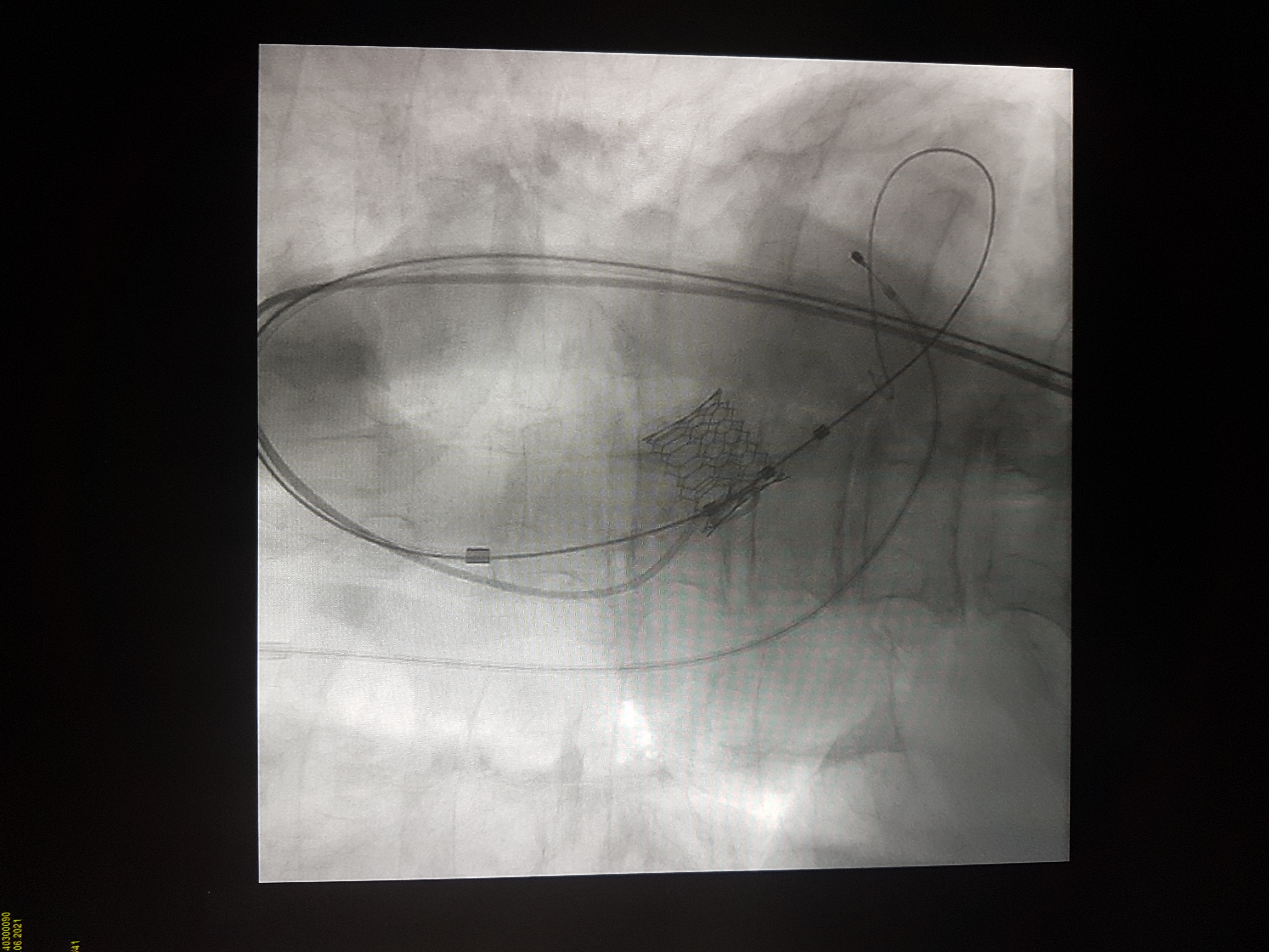 tavi, poseg, sb celje