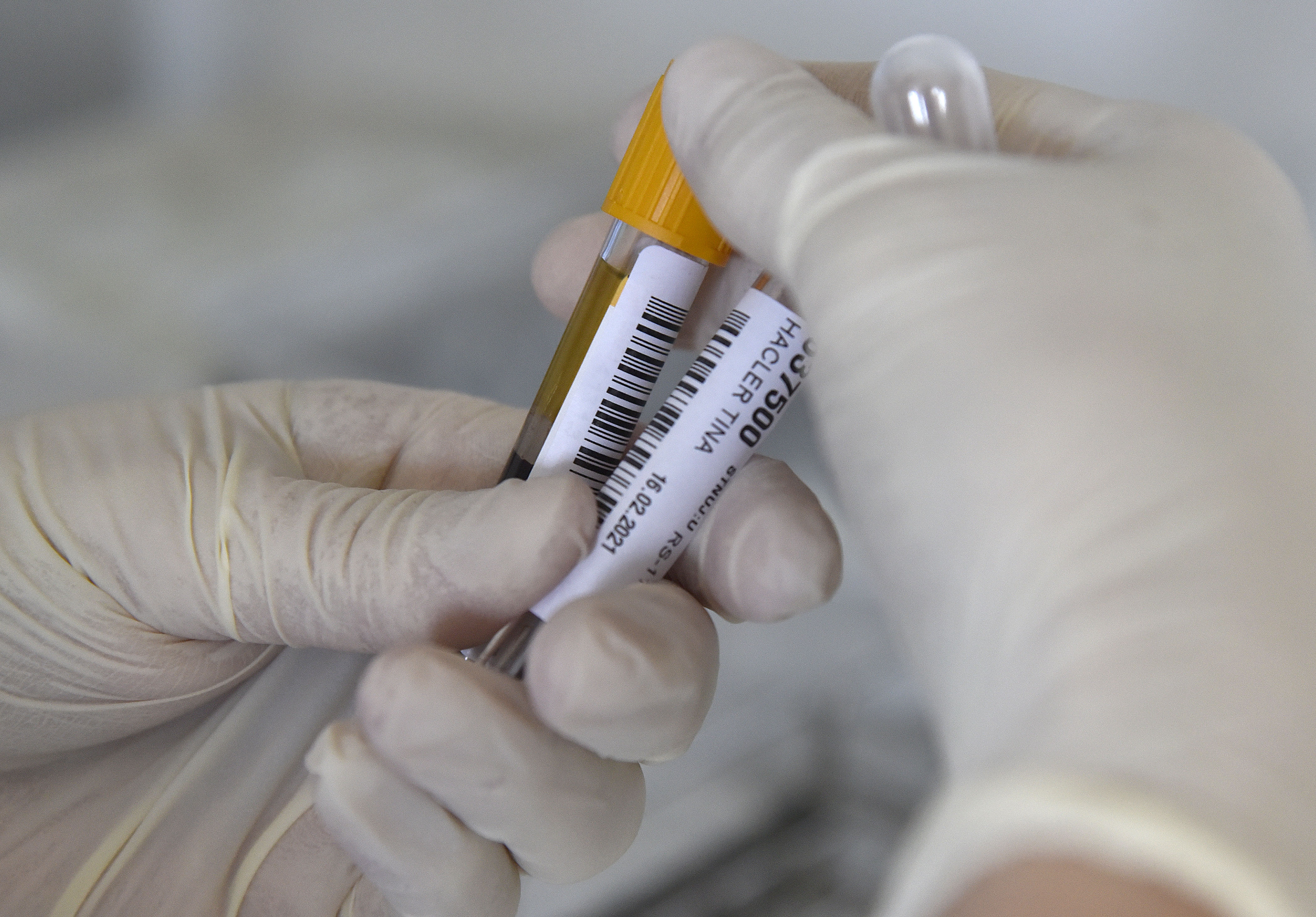 koronavirus,testiranje