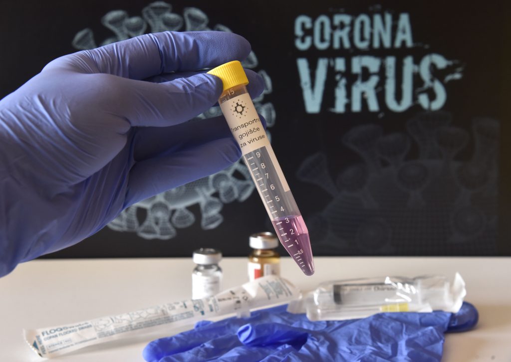 1629449190-koronavirus-testiranje-5-1024x726.jpg