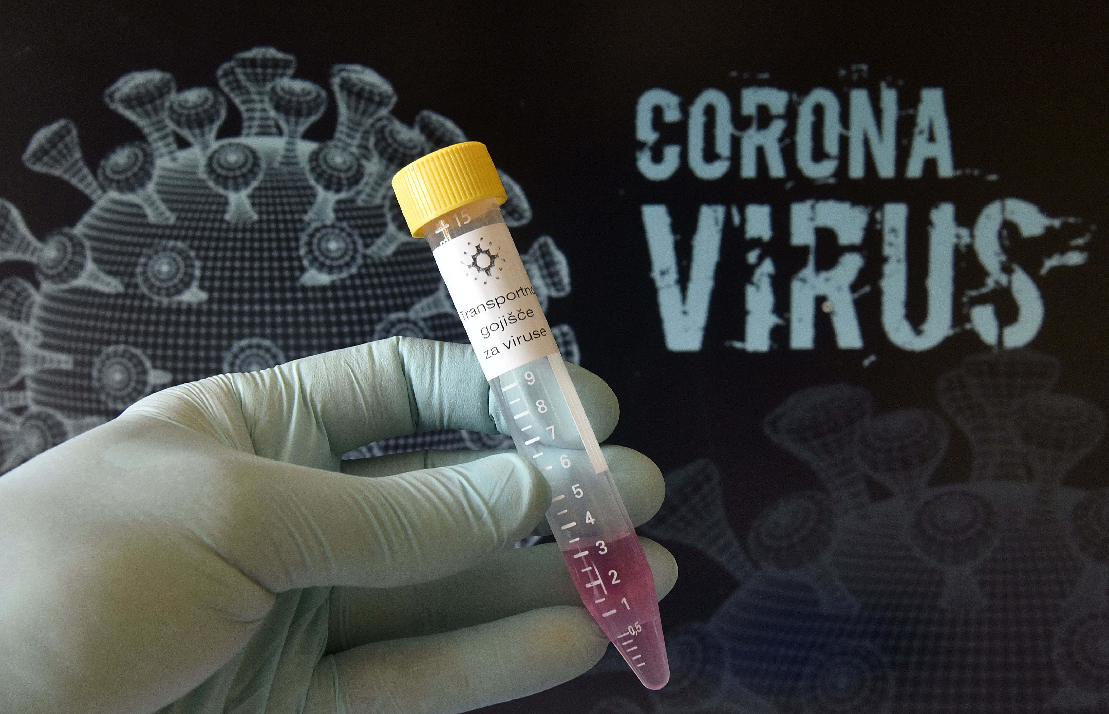 Koronavirus, testiranje, test, covid-19, epidemija, pandemija