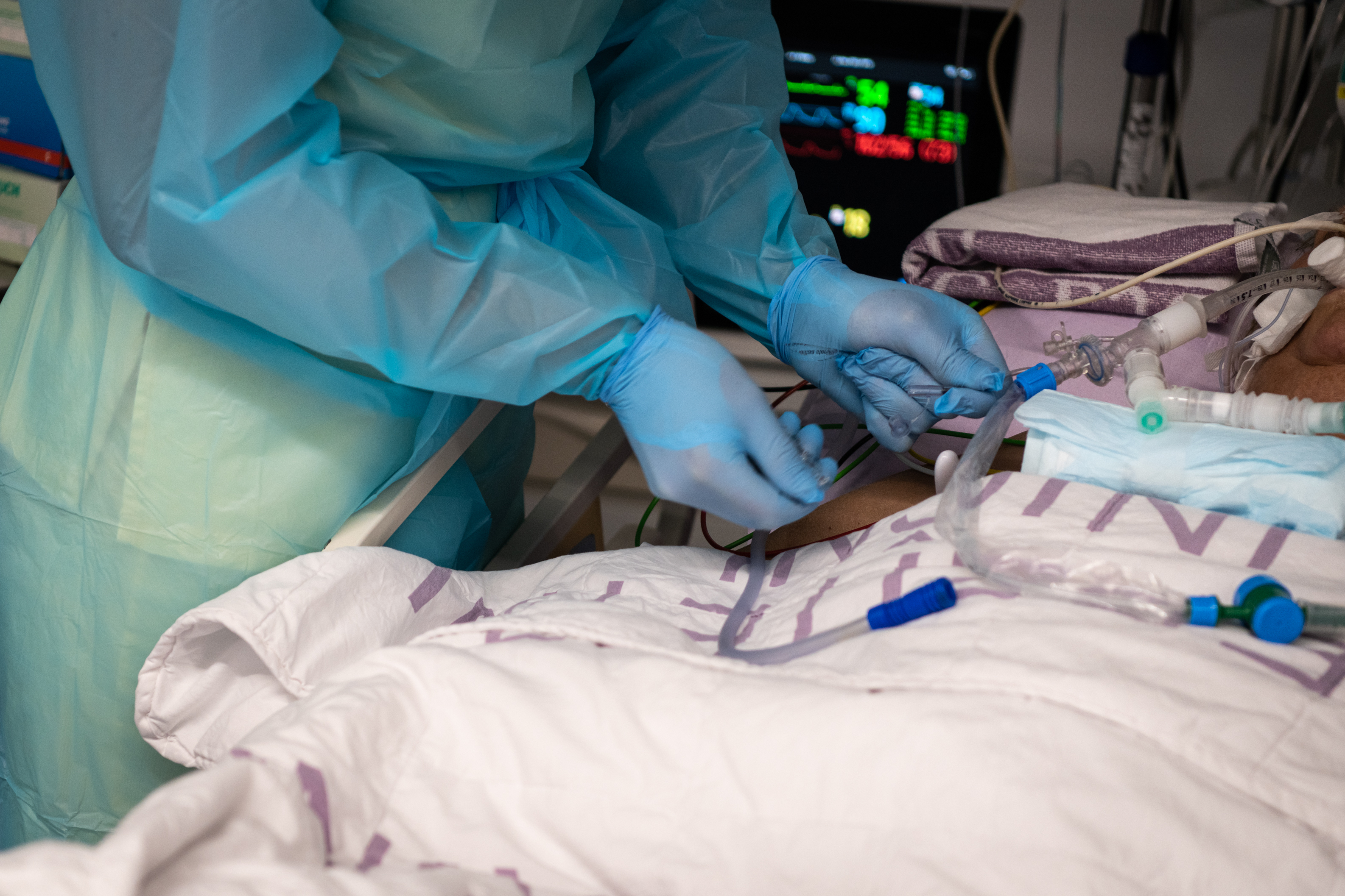 intenzivna nega, dts