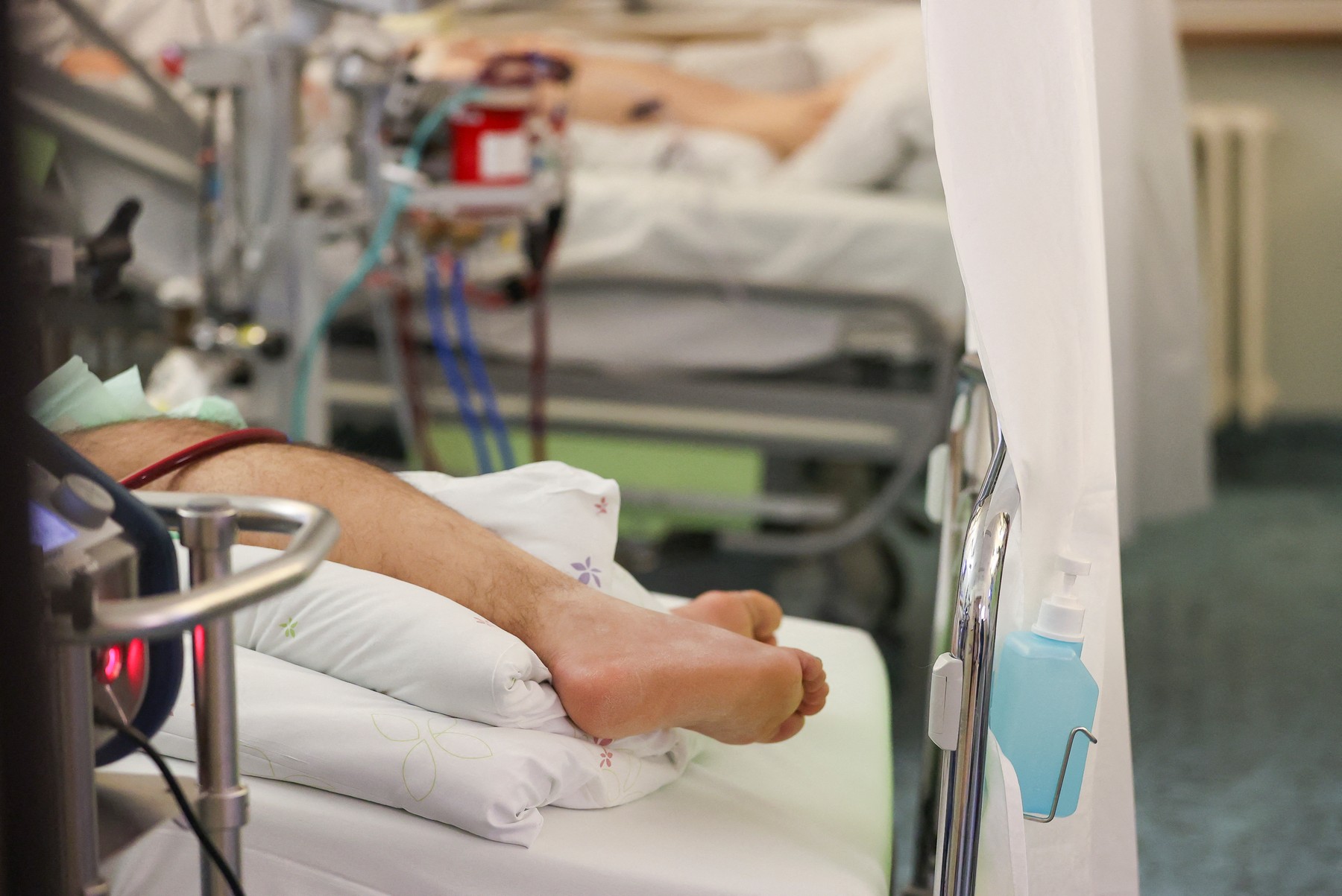 bolnik, covid, ecmo, zunajtelesni krvni obtok,