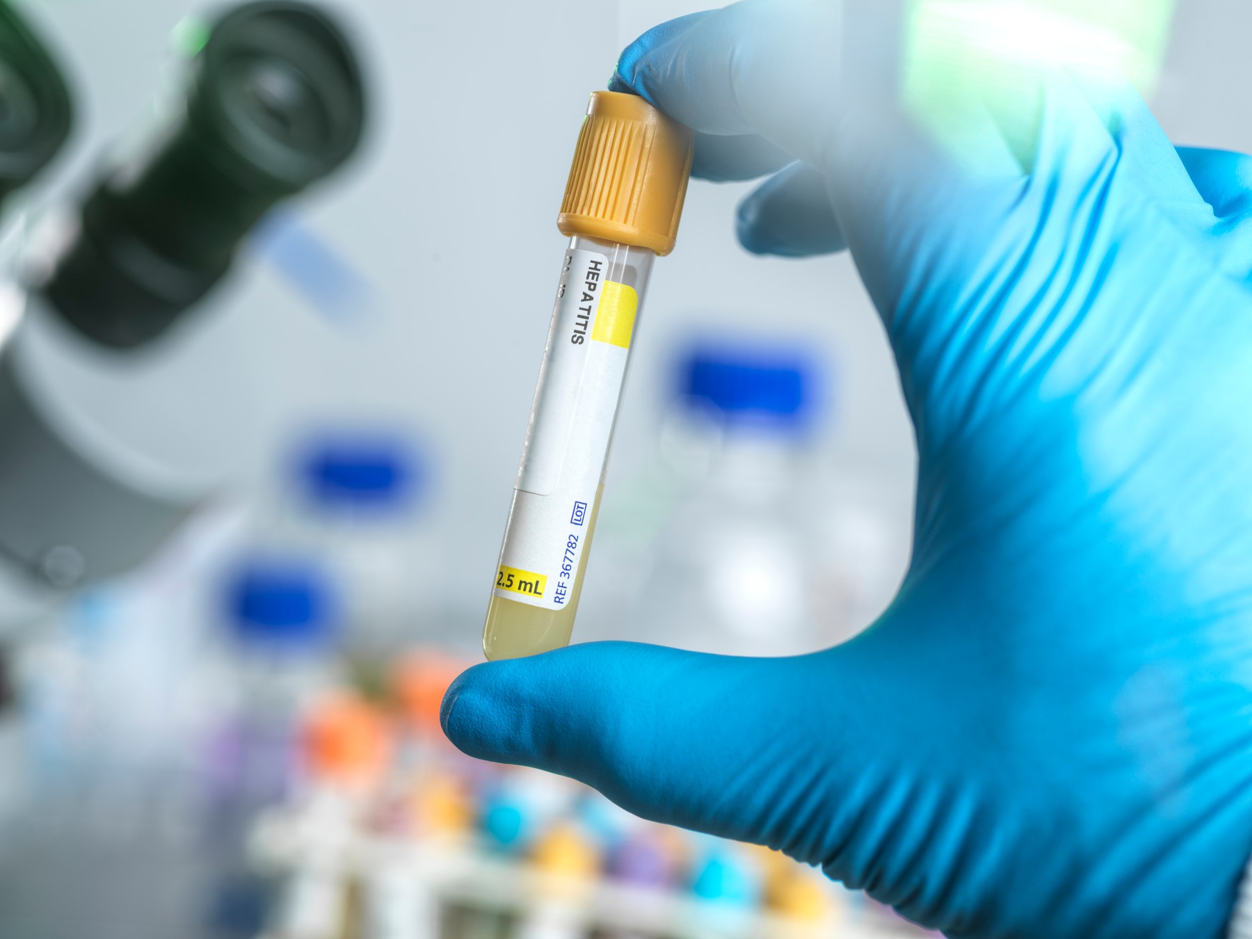 hepatitis, bolezen, epruveta, zdravstvo, zdravje, test