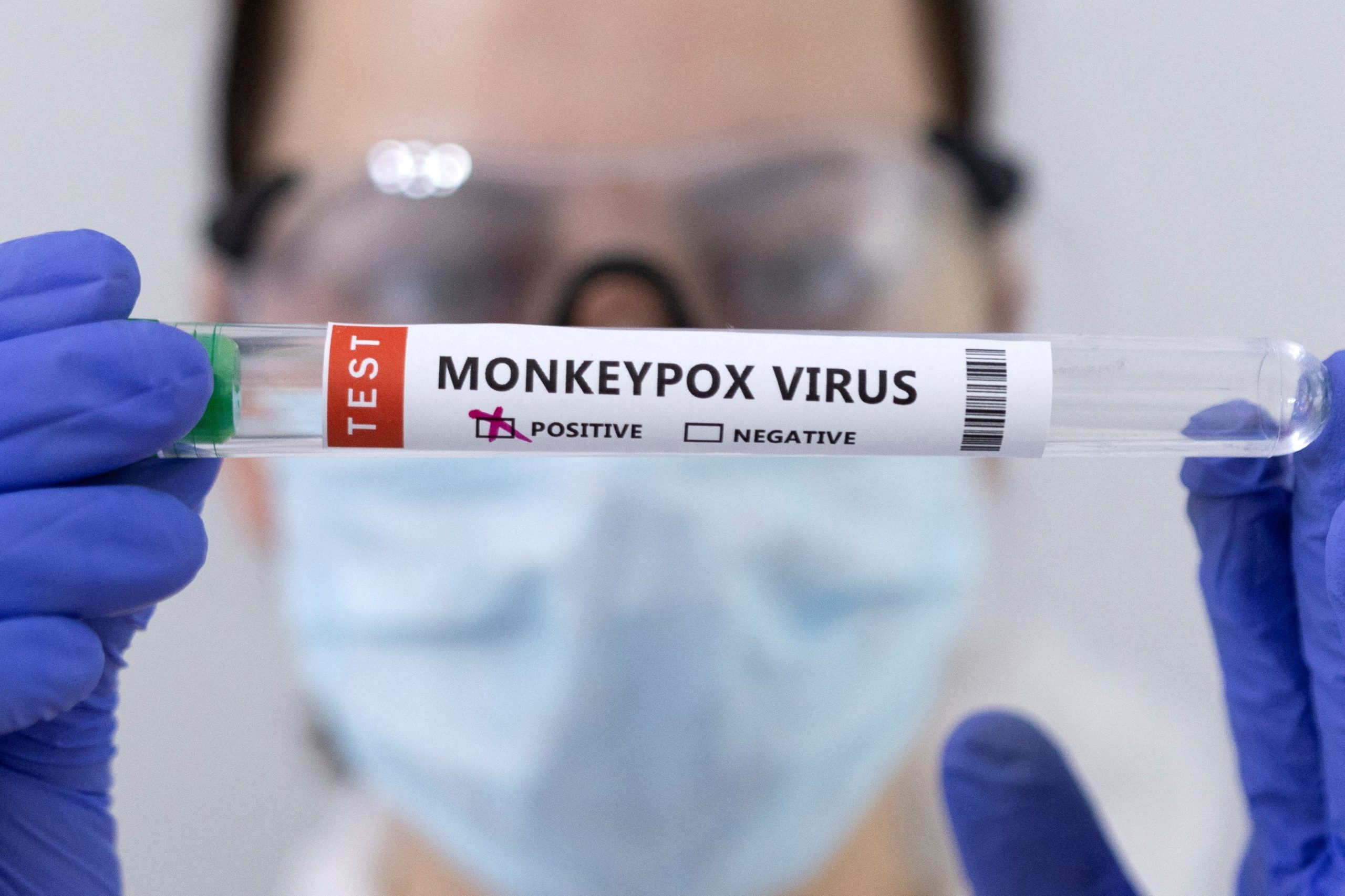 1653371896-2022-05-23T182141Z_475247910_RC25DU95S1NL_RTRMADP_3_HEALTH-MONKEYPOX-scaled.jpg