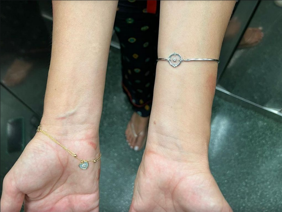 severina, telesne poškodbe