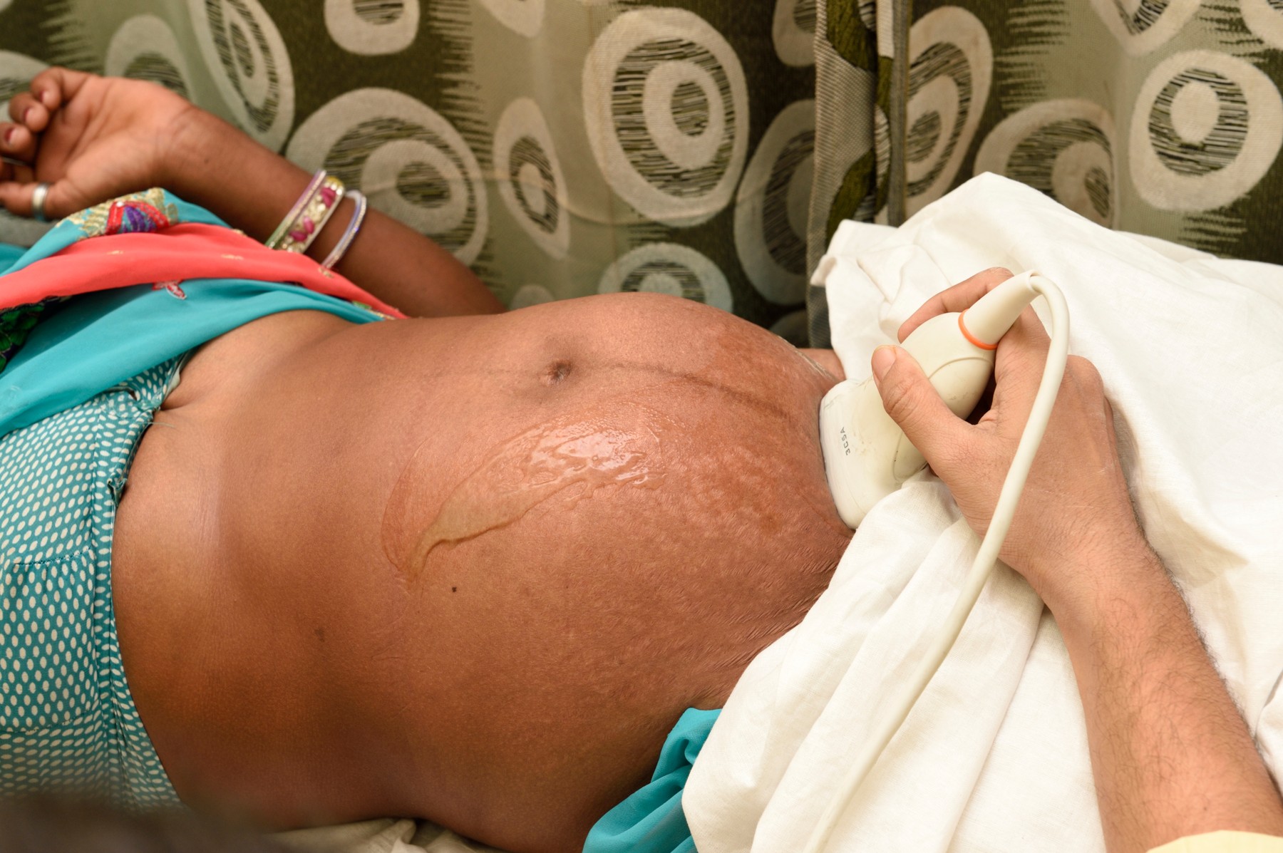 nosečnost, indijka, indija,