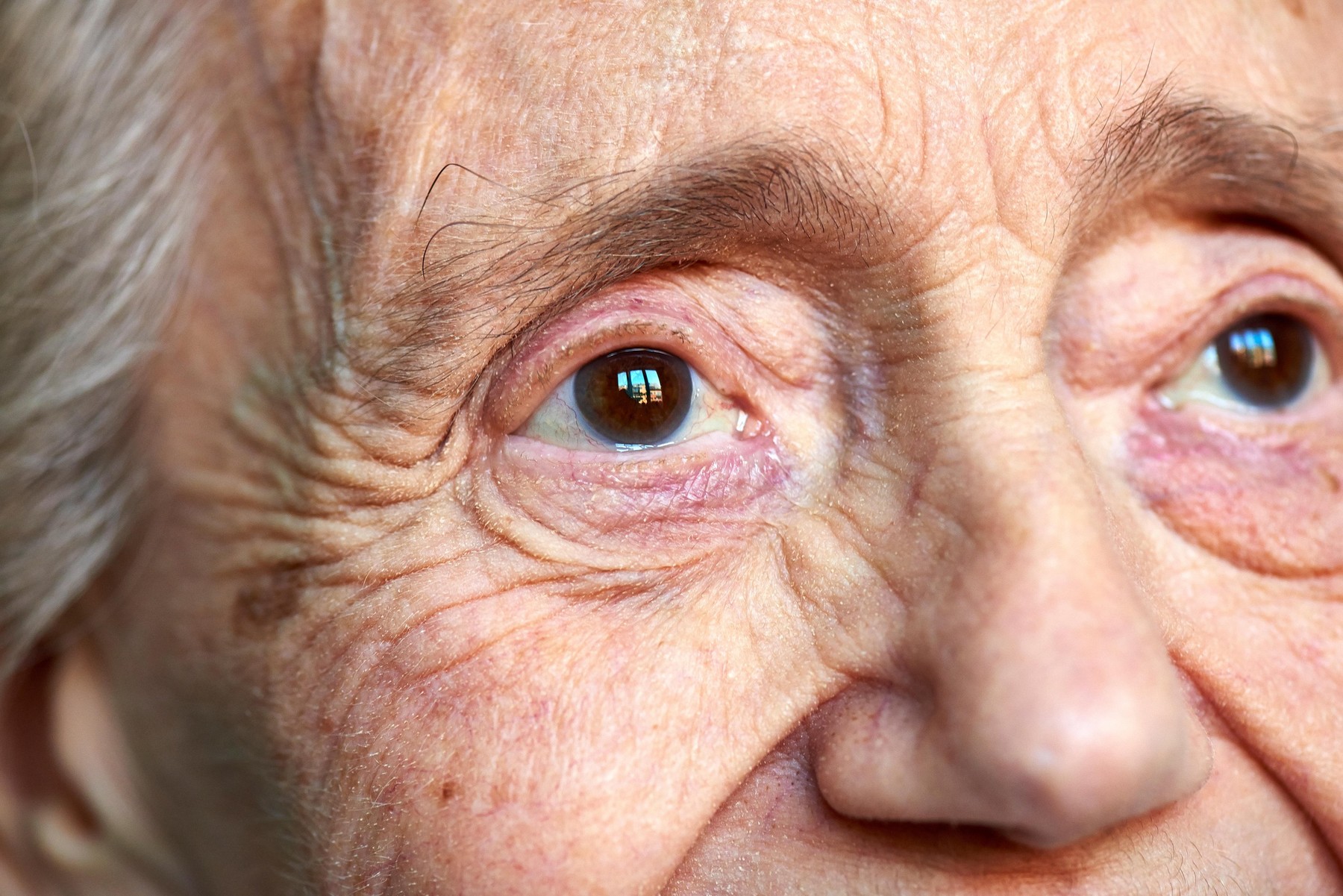 zrela ženska z gubami in pigmentnimi madeži