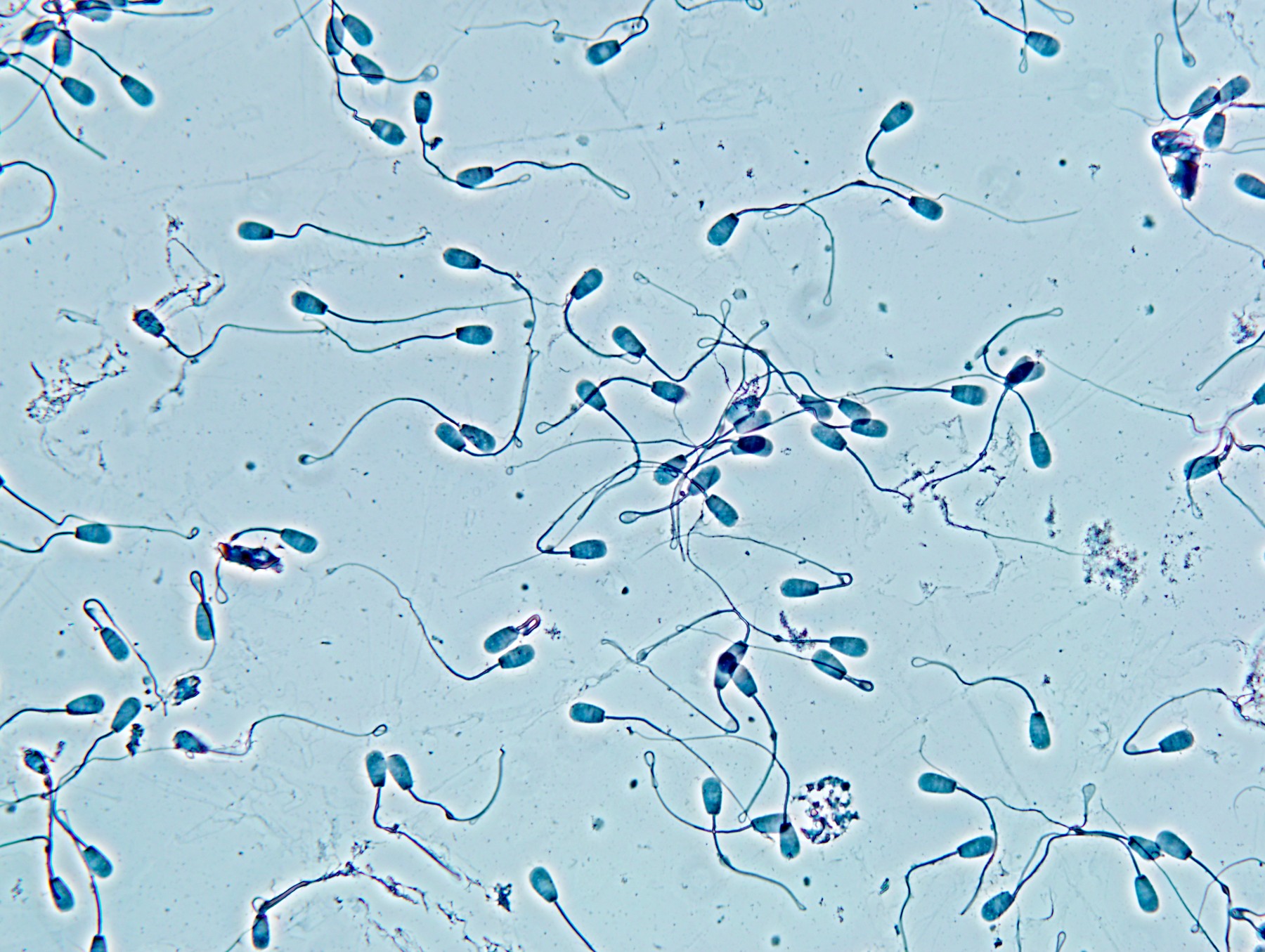 Sperm cells