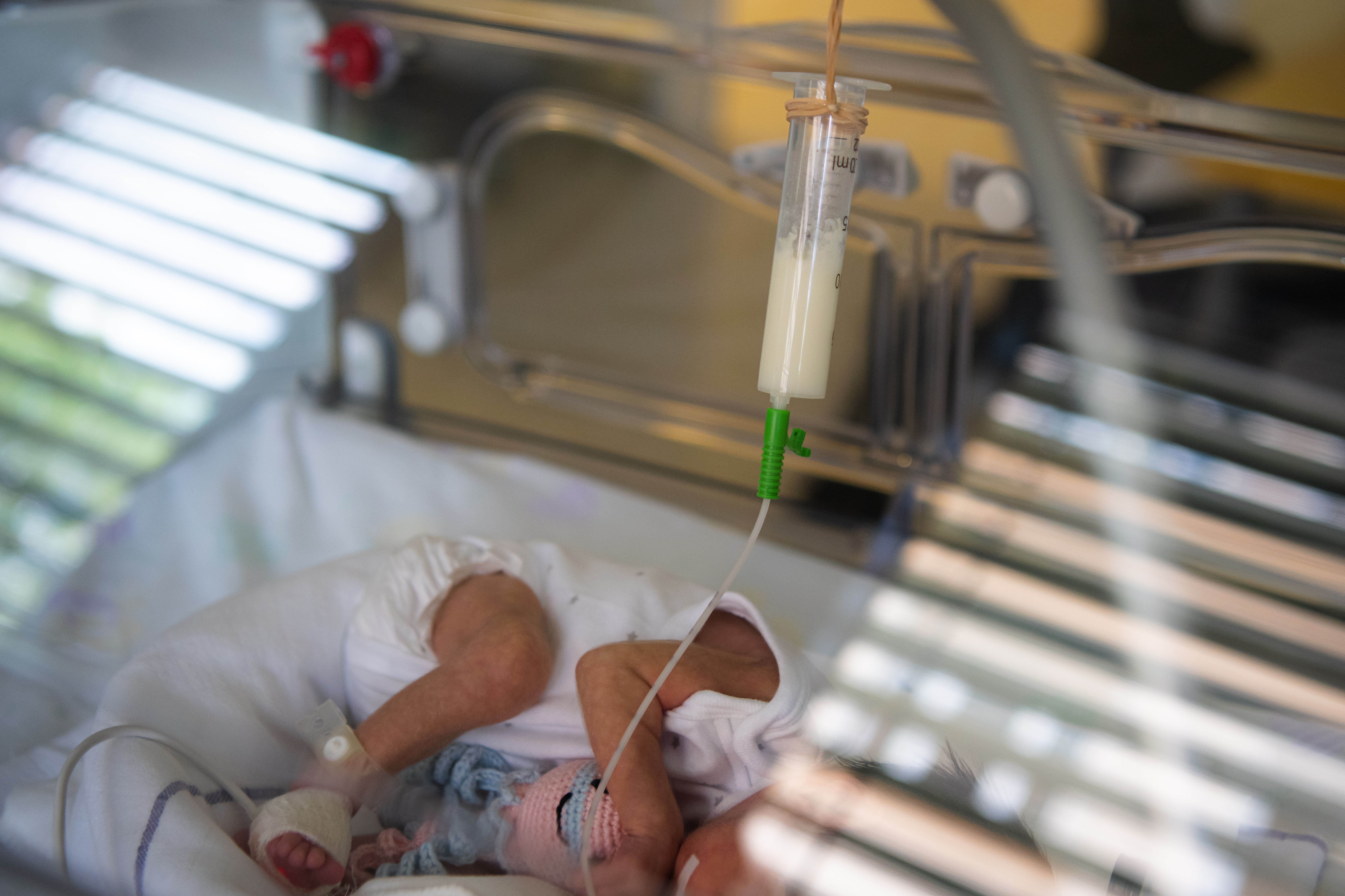 dojenčki, nedonošenčki, mlečna banka