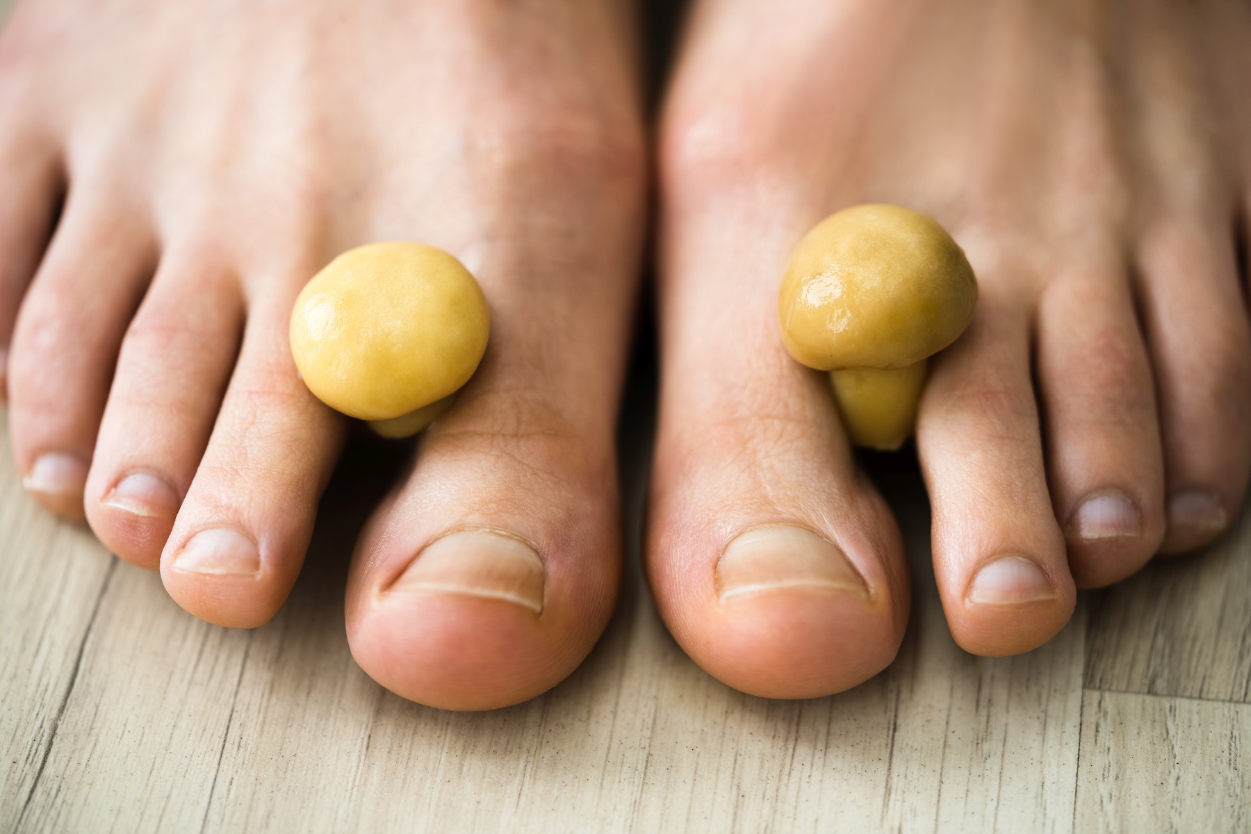 gobe, stopala, glivice