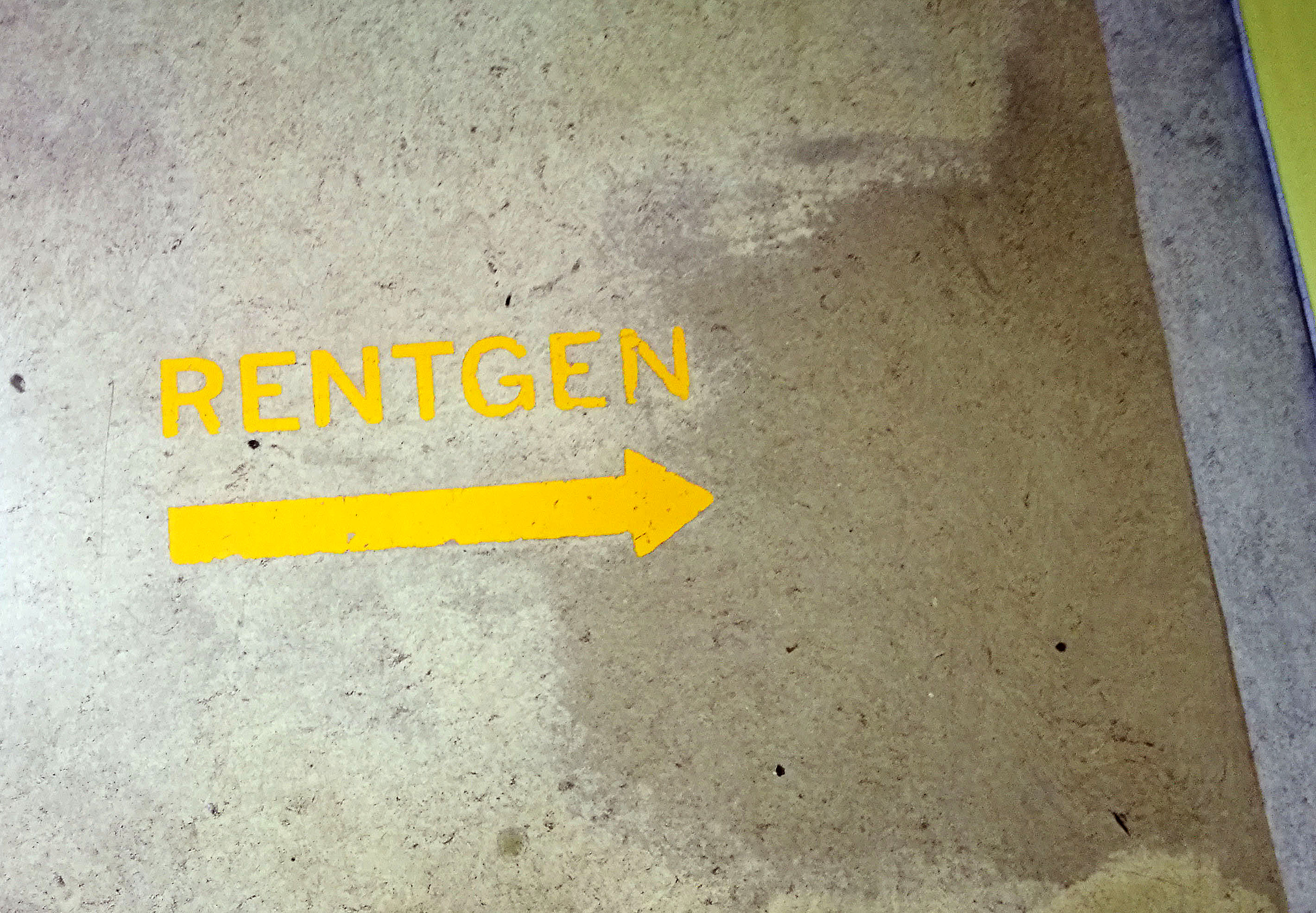 Rentgen, klinični center ljubljana