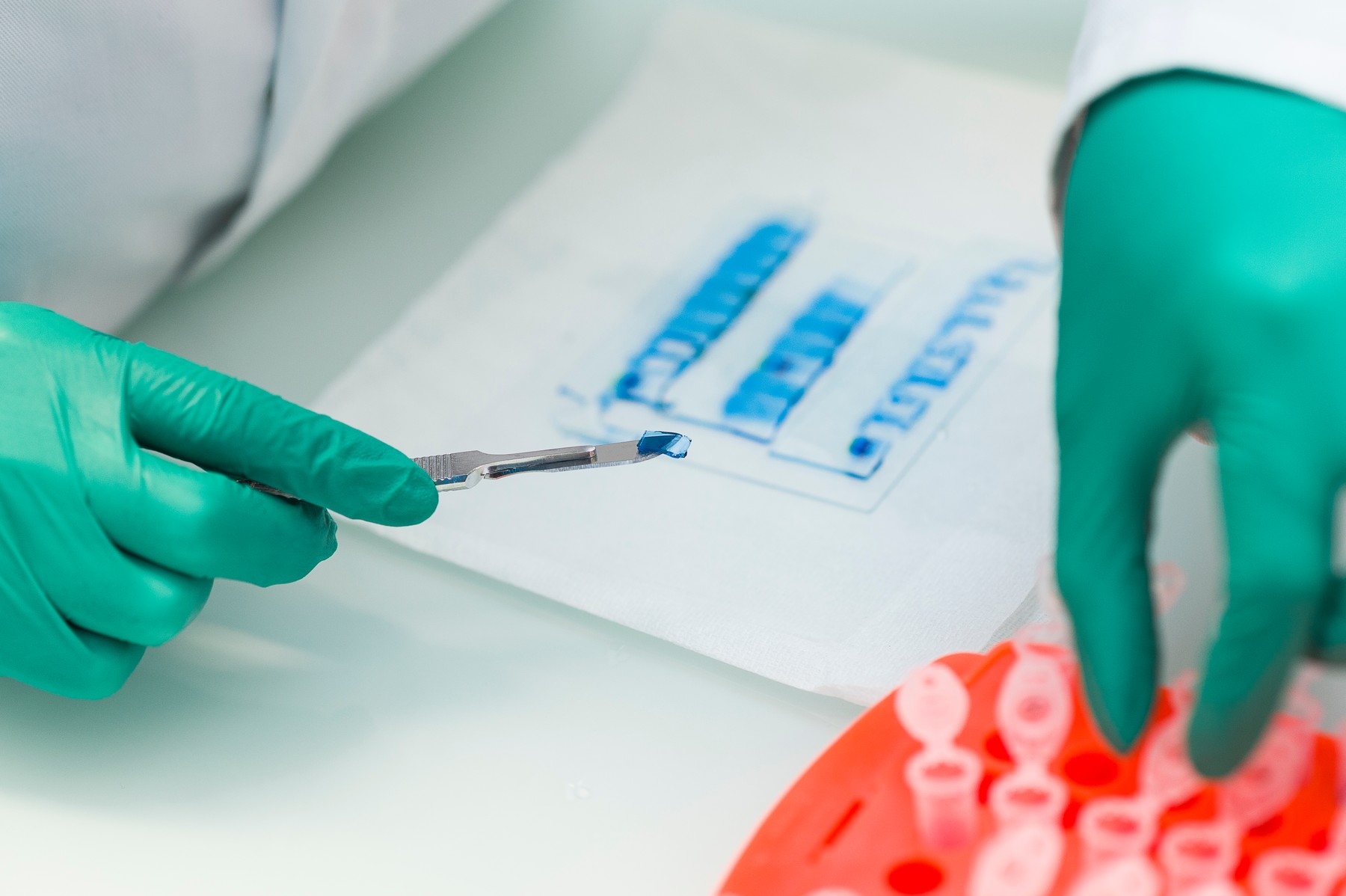 rak, diagnoza, zdravniki