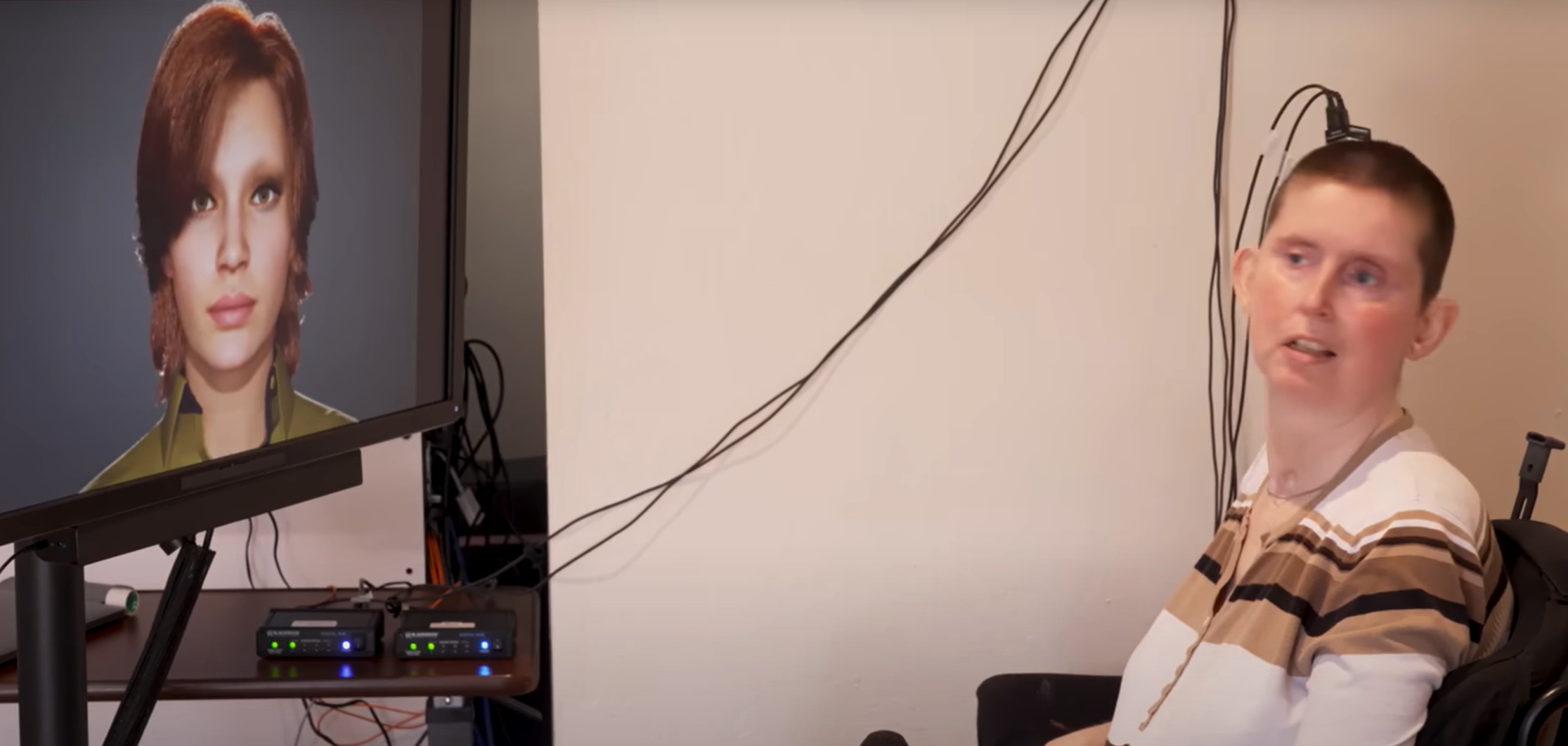 Ann Johnson, umetna inteligenca, rehabilitacija, govor, sindrom zaklenjenosti