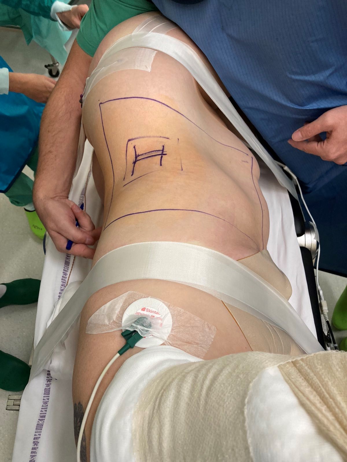 Predoperativna priprava (foto_arhiv Lovro Suhodolčan)