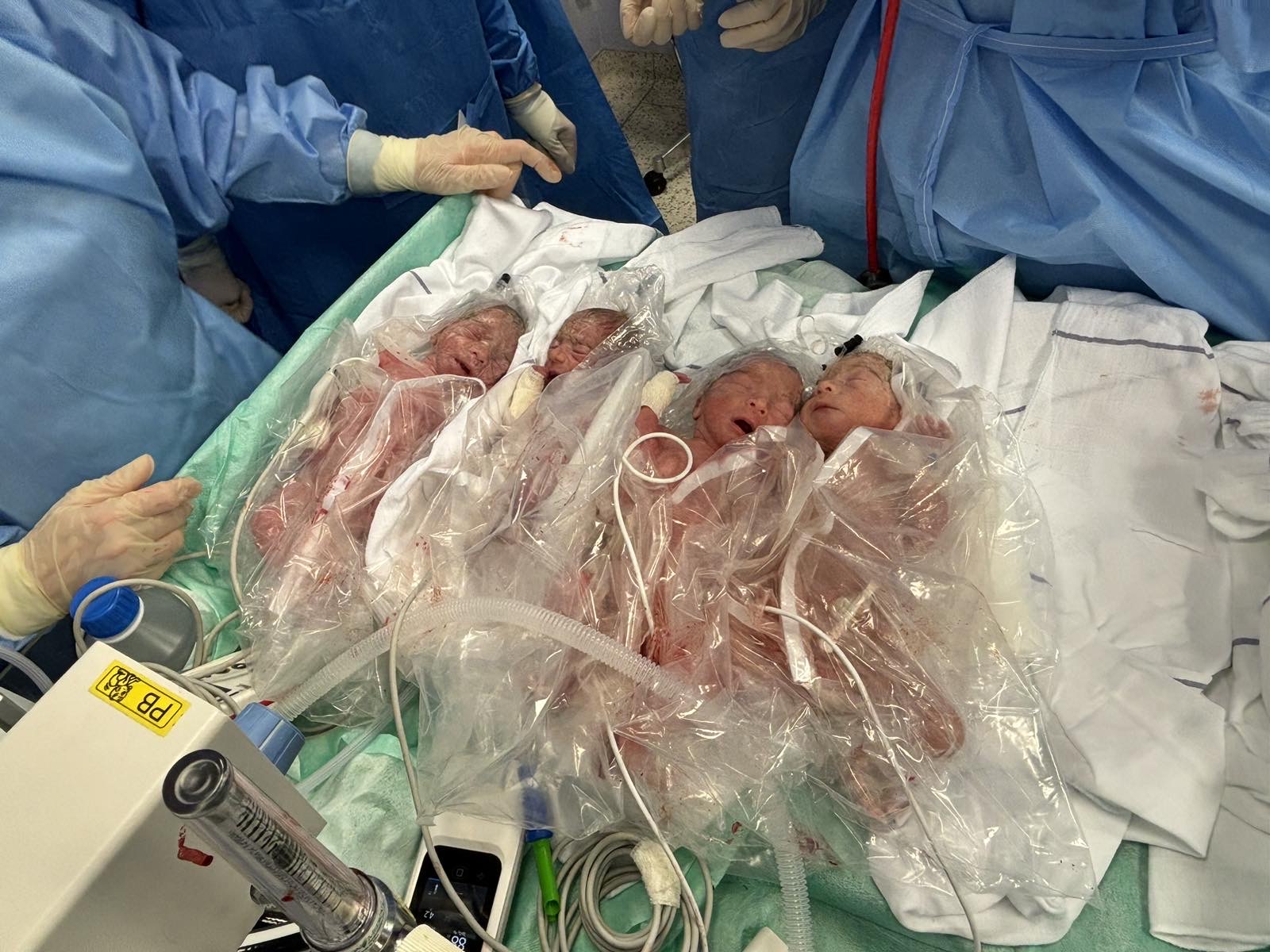 četverčki , porodnišnica ljubljana