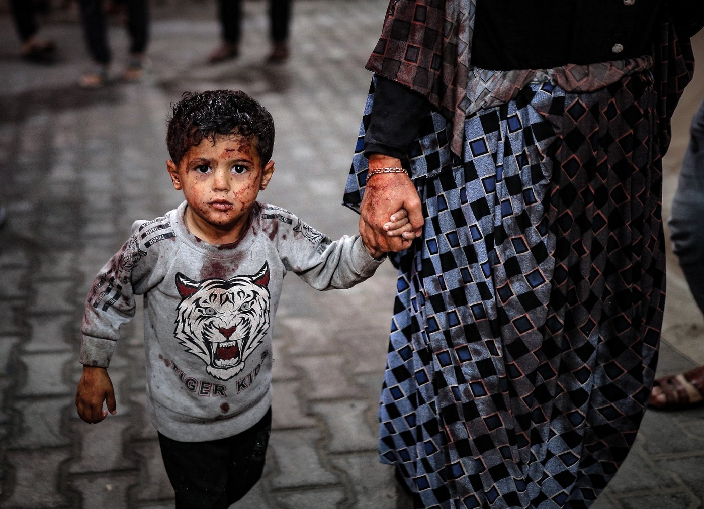 Poškodovani palestinski otroci po izraelskem napadu na Rafo (Foto: PROFIMEDIA)