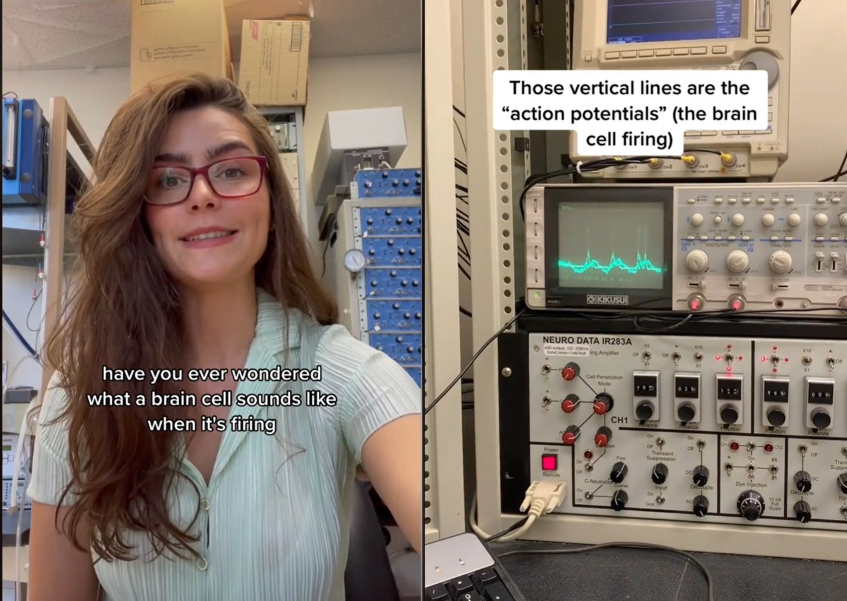 kako zvenijo možgani