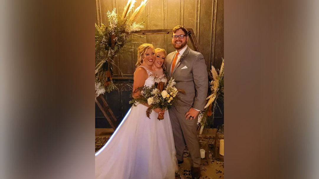 siamski dvojčici, dicephalus, Abby, Brittany, Hensel, poroka