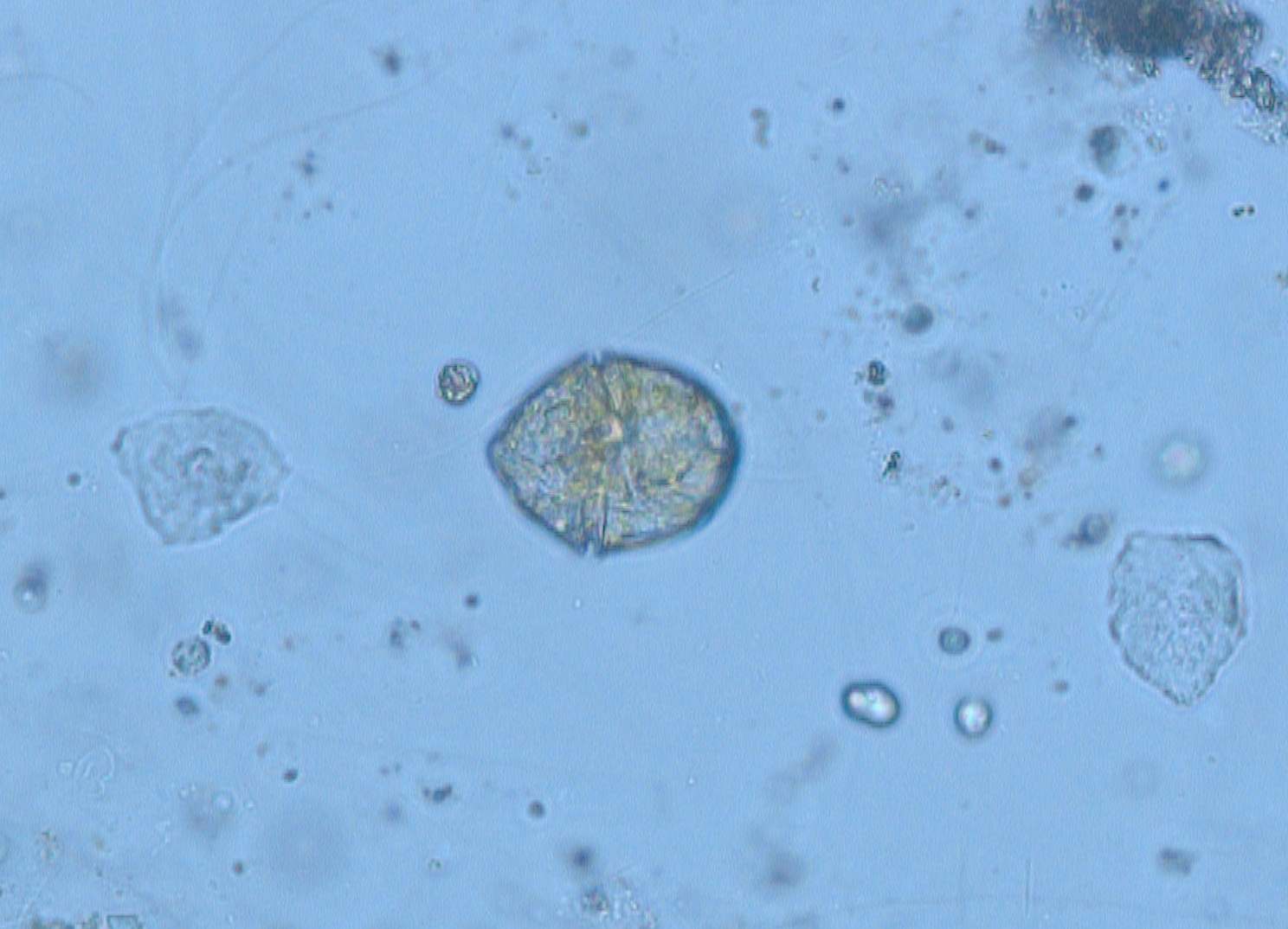 Mikroskopski posnetek  sluzi nabrane na morskem dnu. (Foto: NIB)