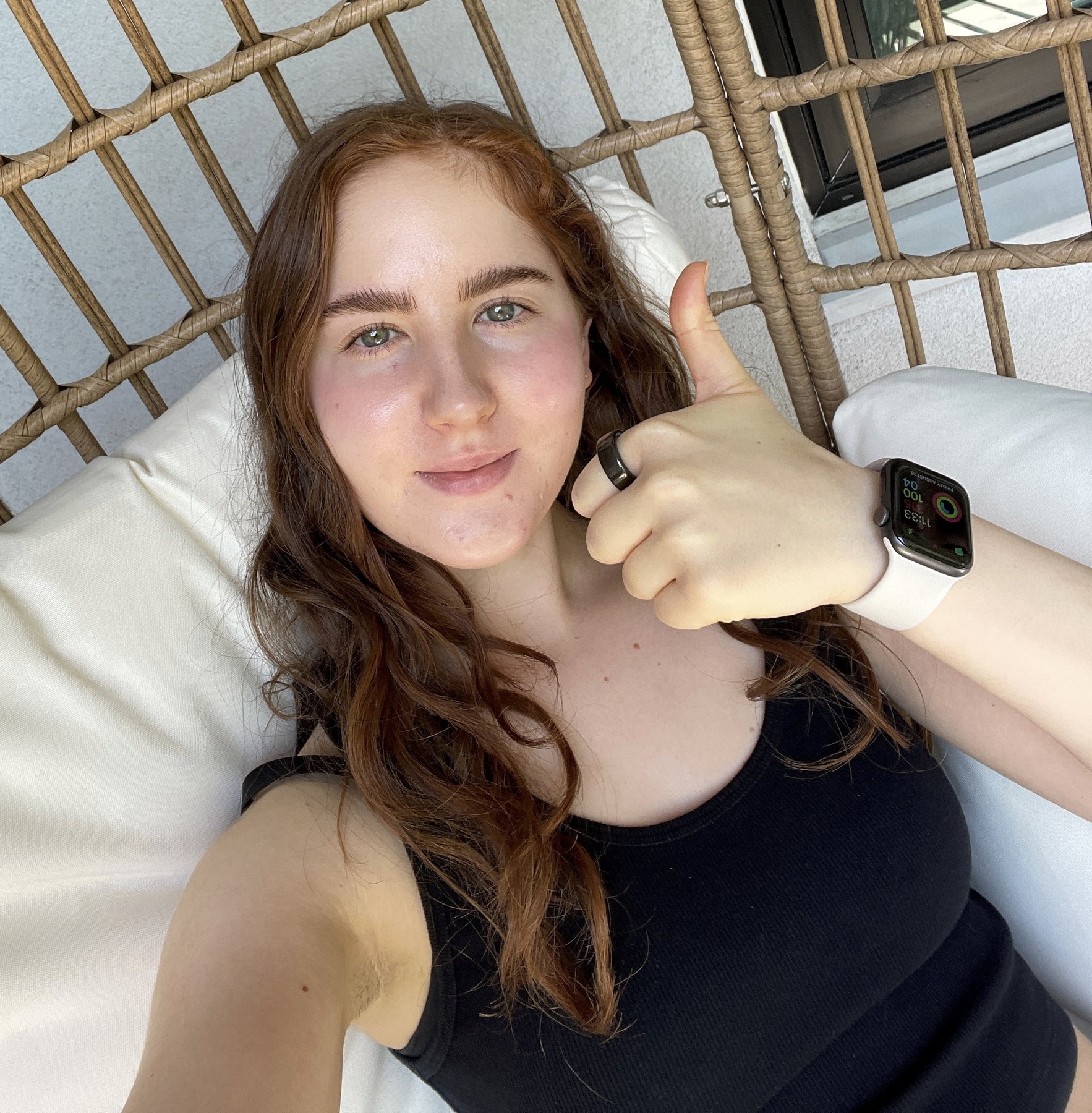 Jenna Gestetner, alergije, mcas