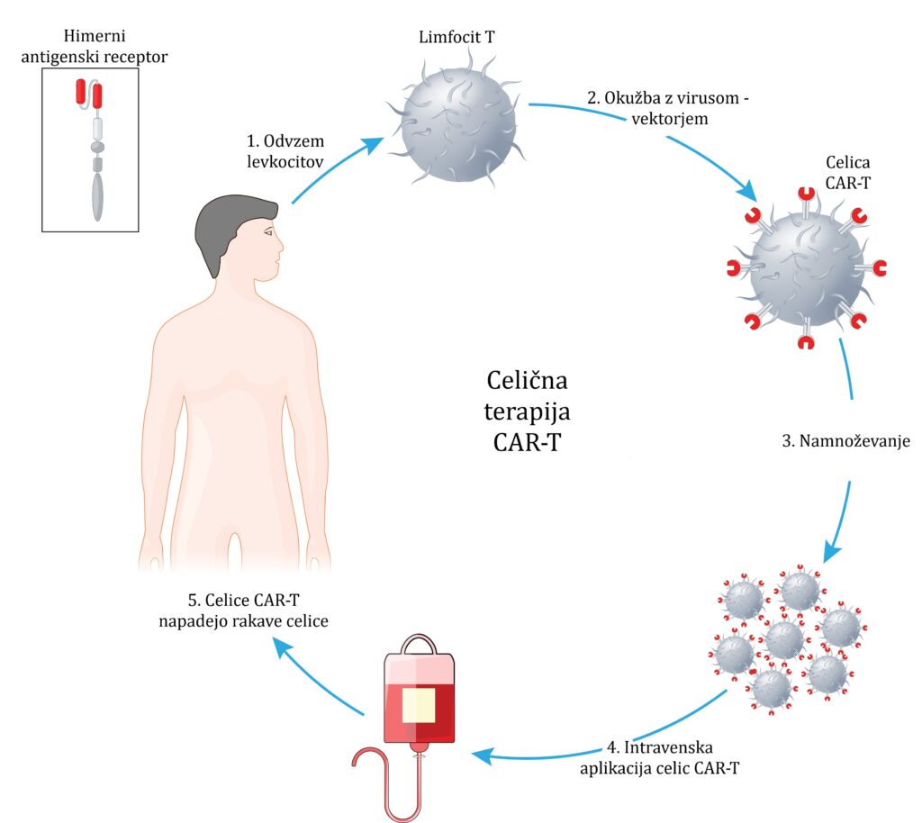 1724853575-Shematski-prikaz-priprave-celic-CAR-T-1024x914.jpg