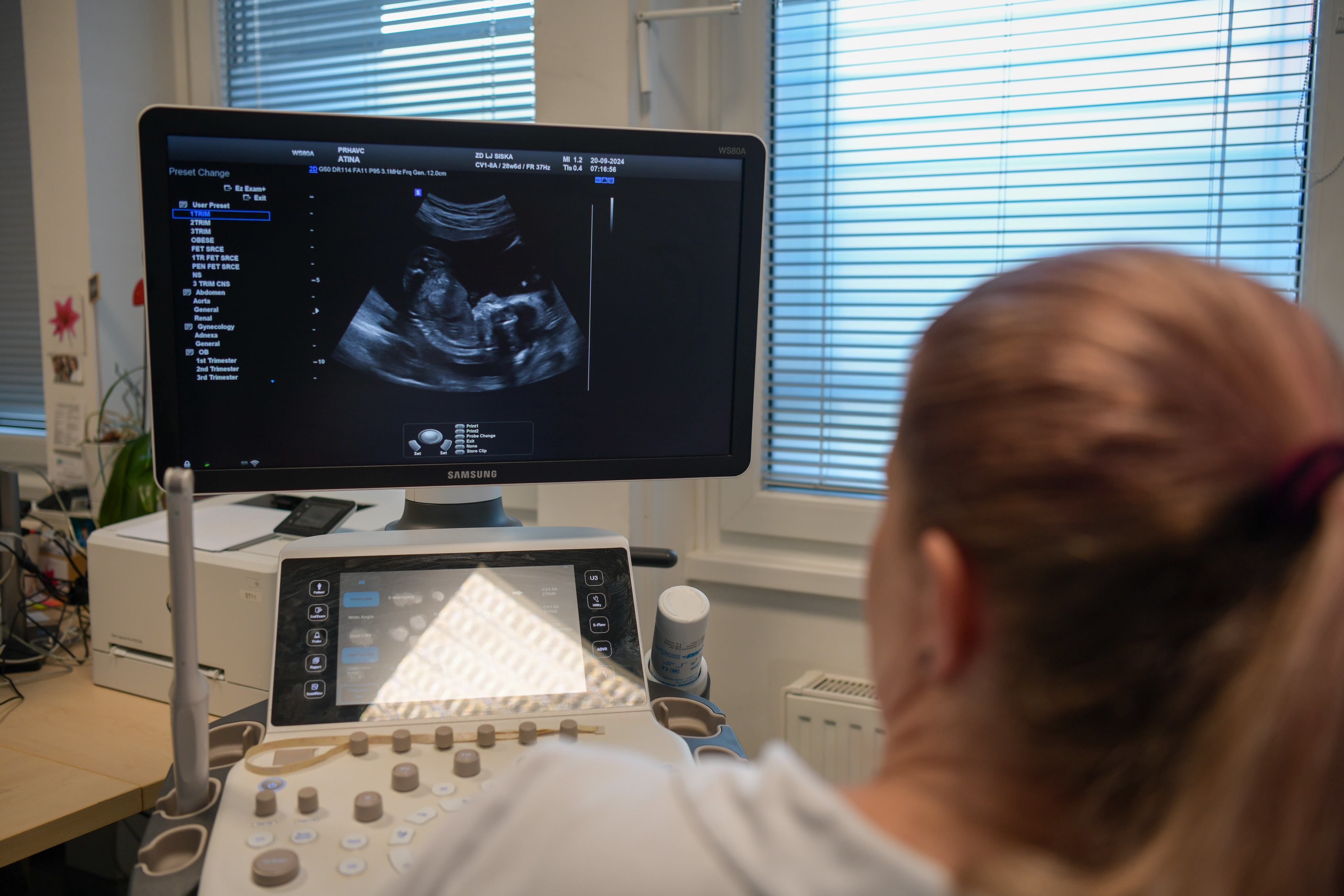 Ginekologinja, ginekološka ambulanta, ultrazvok