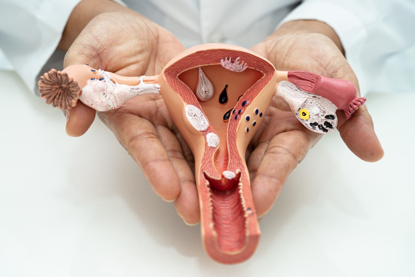 MATERNICA, JAJČNIKI, REPRODUKTIVNI SISTEM