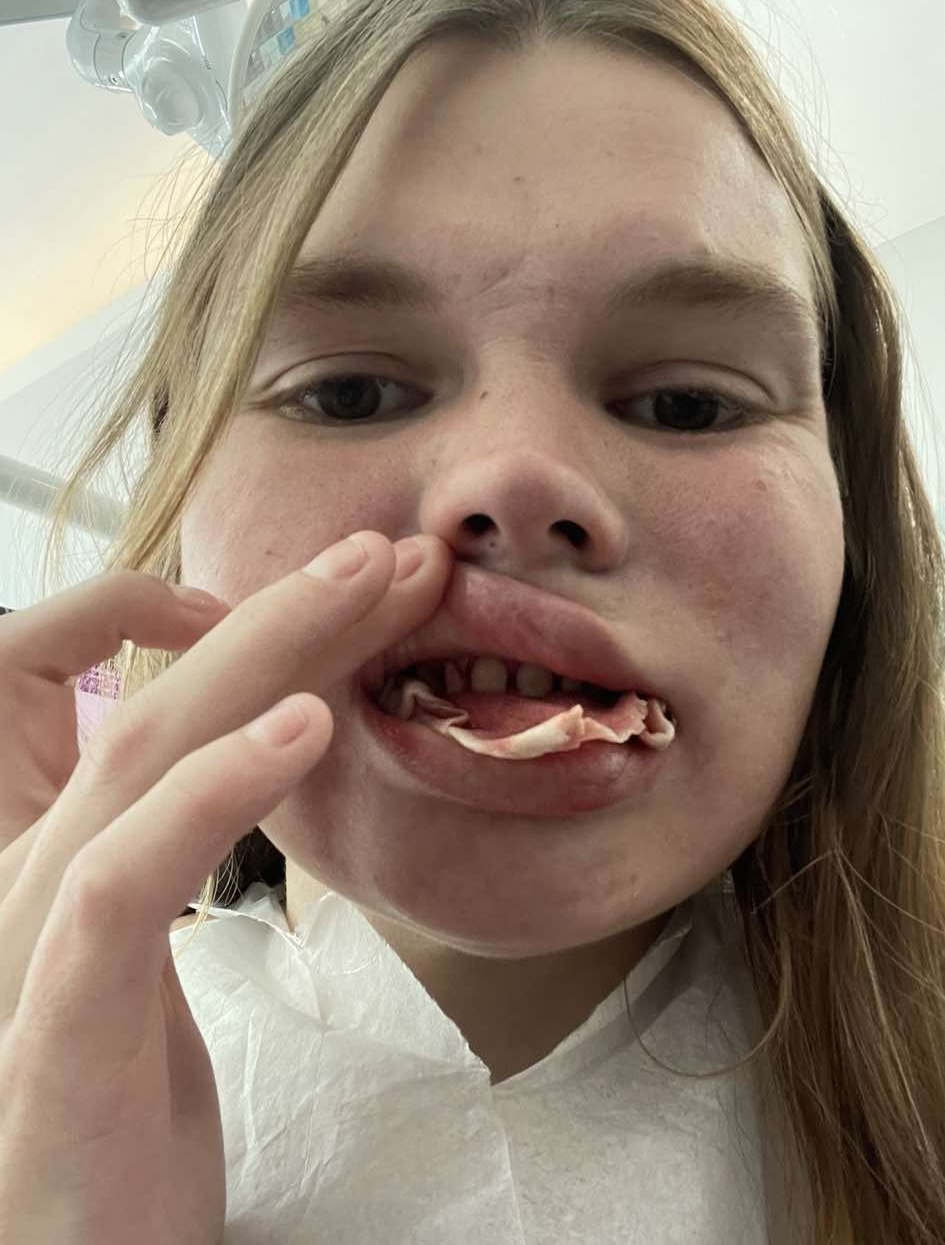 Alana Boone, belgijka, neuspešen poseg