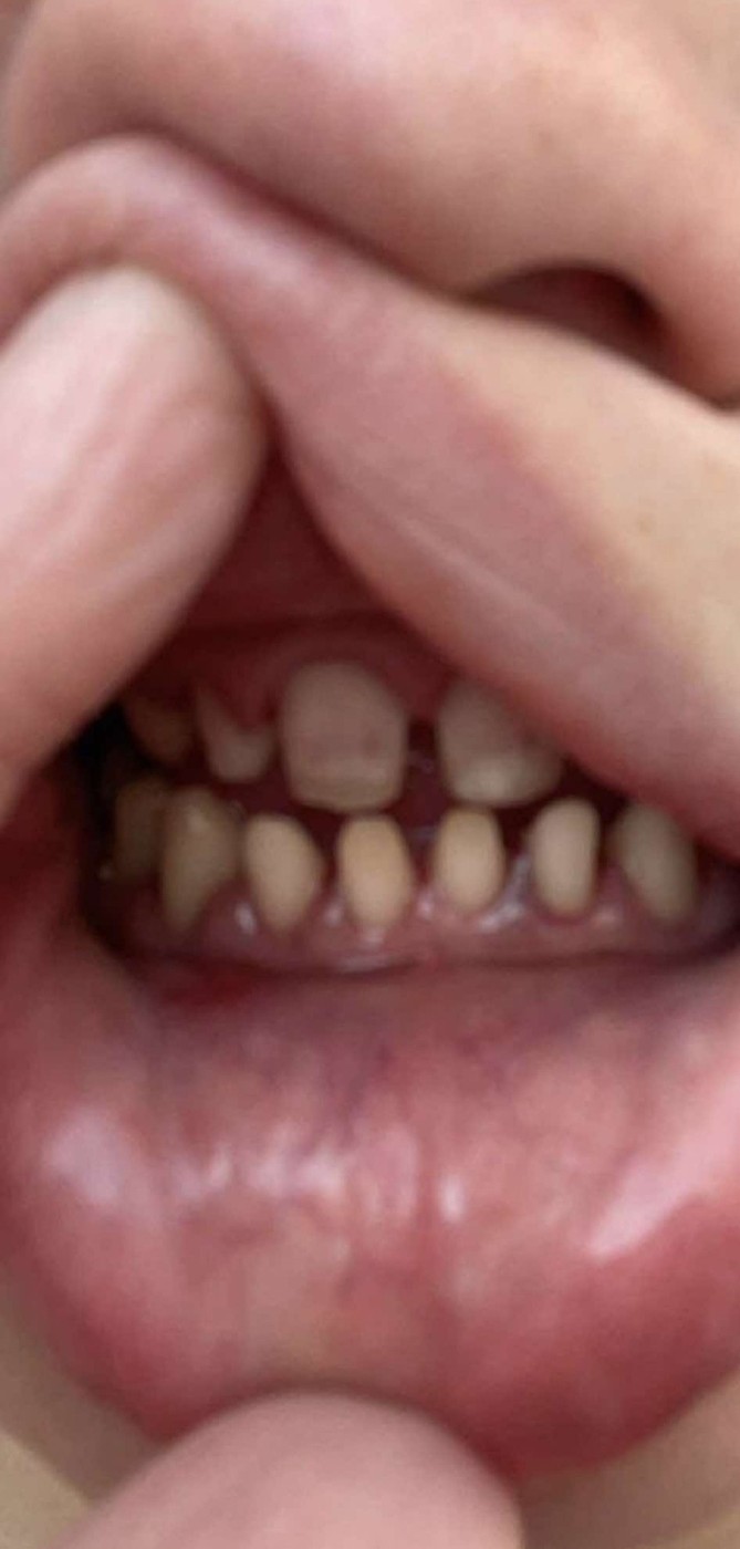 Alana Boone, belgijka, neuspešen poseg