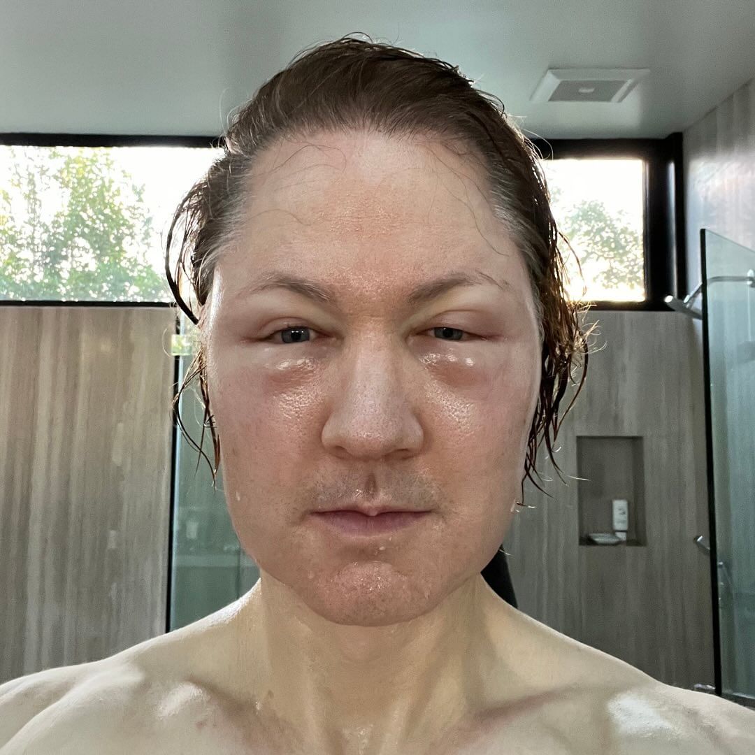 Neuspeli eksperiment. (Foto@bryanjohnson_/INSTAGRAM)