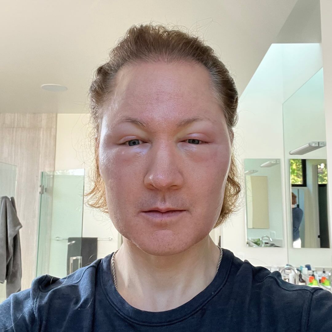 bryan johnson, lepotni eksperiment