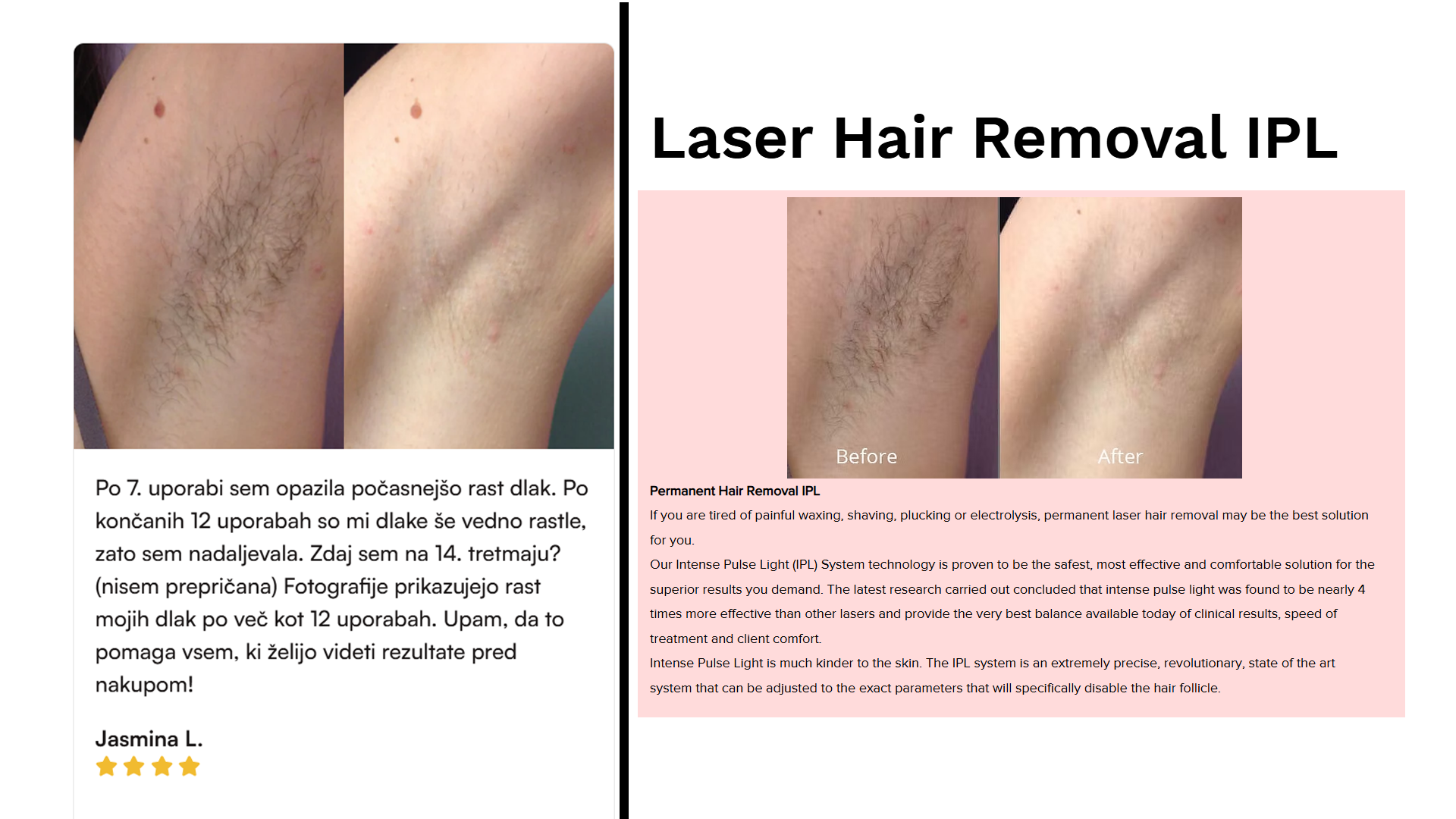 Enaka fotografija, ki jo uporabljata slovensko in avstralsko podjetje.(Foto: Posnetek zaslona slovenskega podjetja in podjetja Dyosa aestetics)