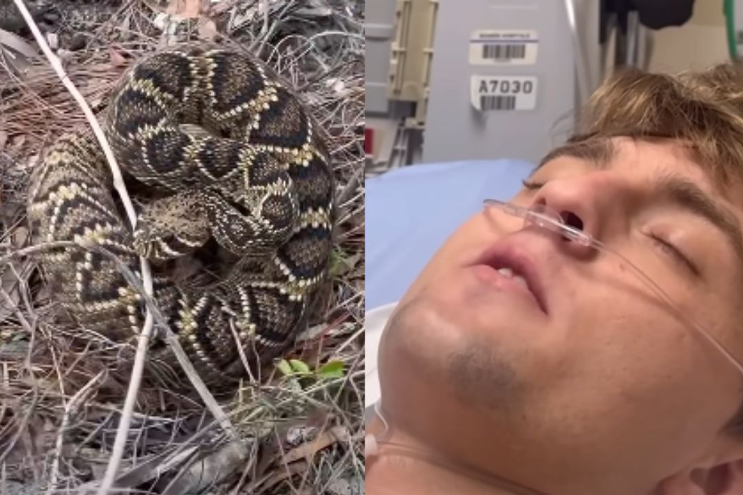 kačji ugriz, kača, klopotača, vplivnež