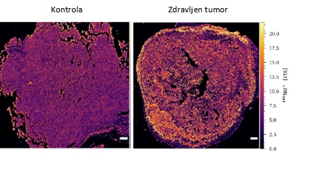 1737539623-ZDRAVLJEN-TUMOR.jpg