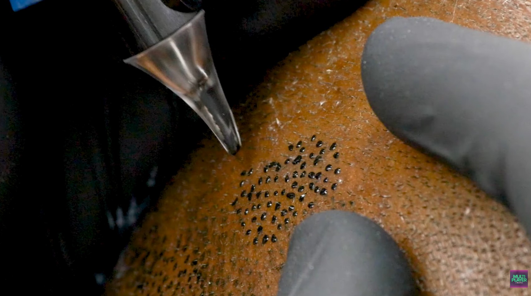 Mikropigmentacija lasišča