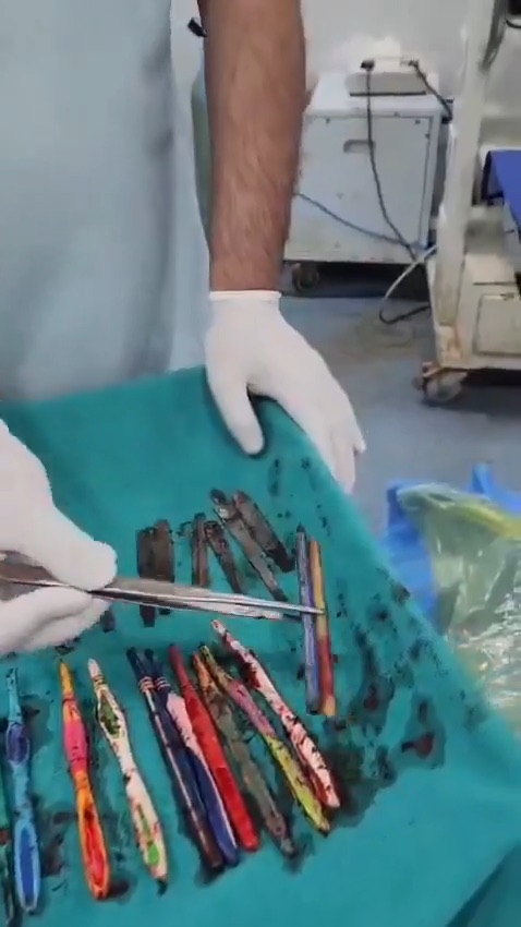 Indijec pojedel zobne ščetke