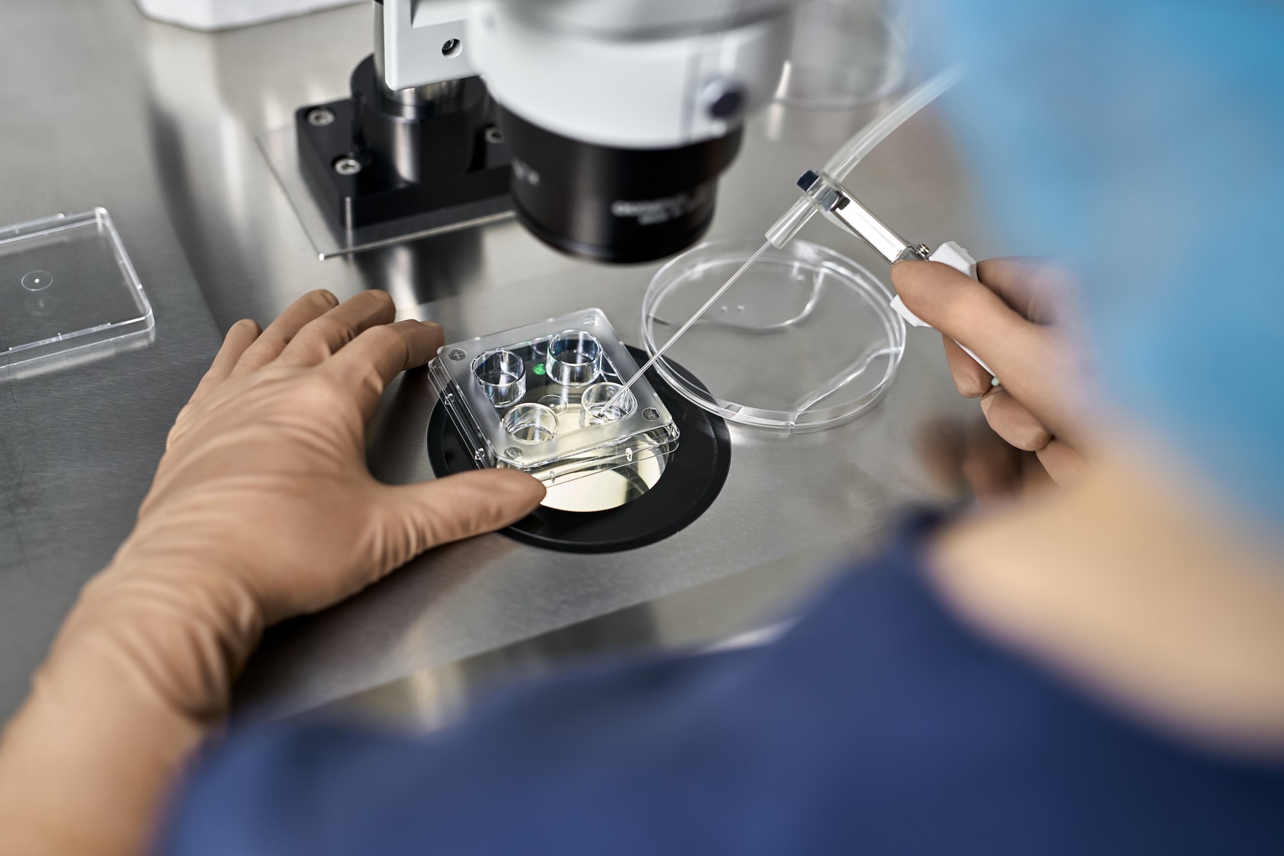 nosečnost, ivf, ginekolog, obmp, umetna oploditev